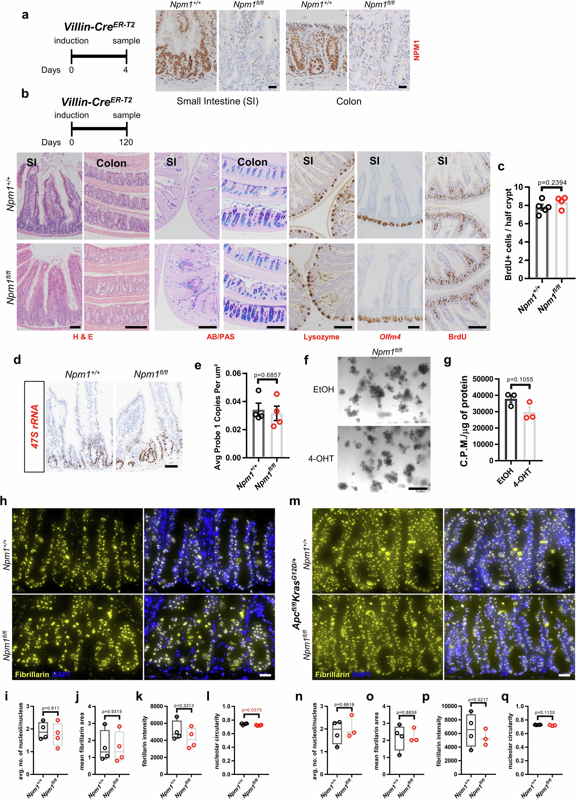 Extended Data Fig. 4: NPM1 is dispensable for adult intestinal tissue homeostasis.