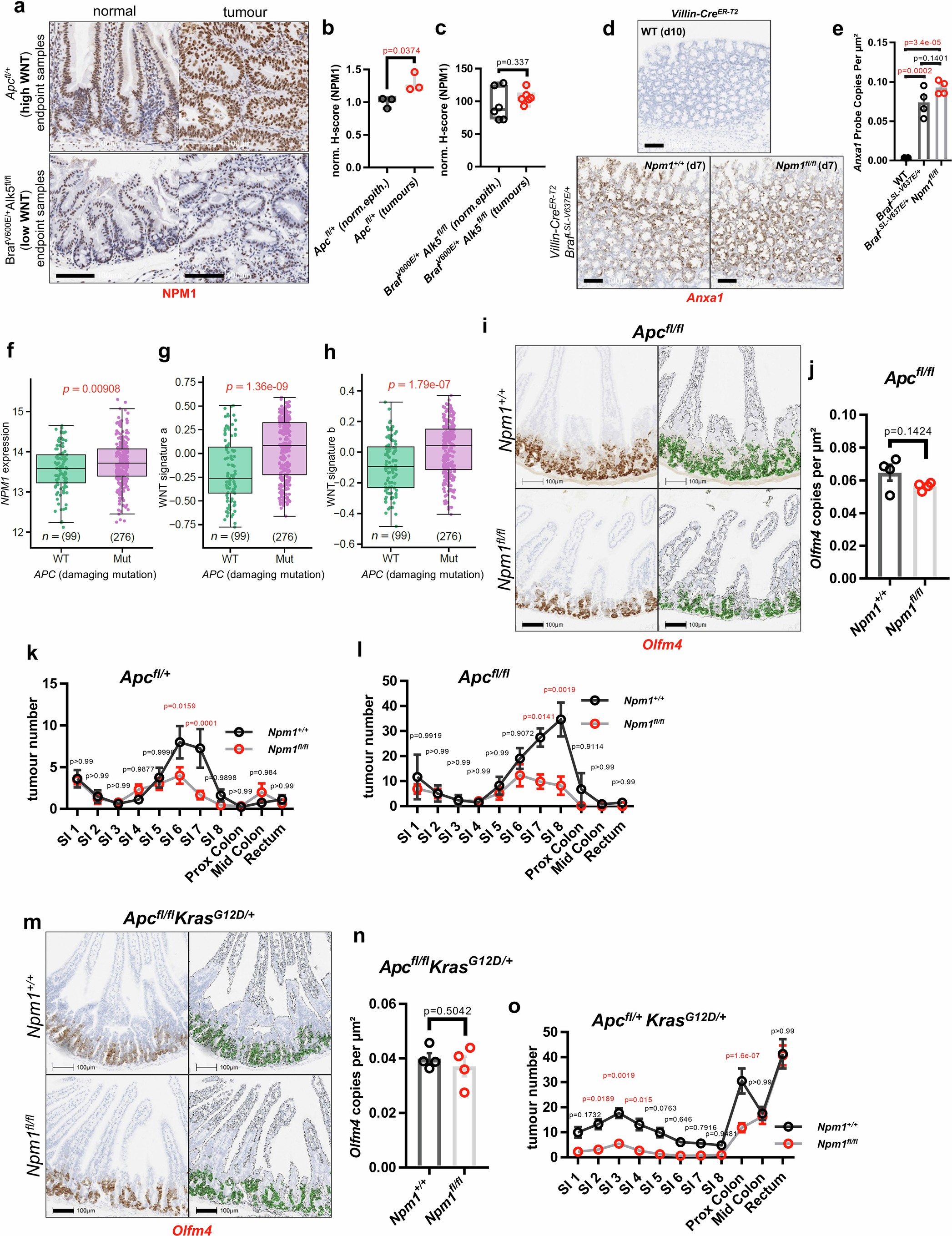 Extended Data Fig. 5: NPM1 is upregulated and necessary for WNT-driven tumourigenesis.