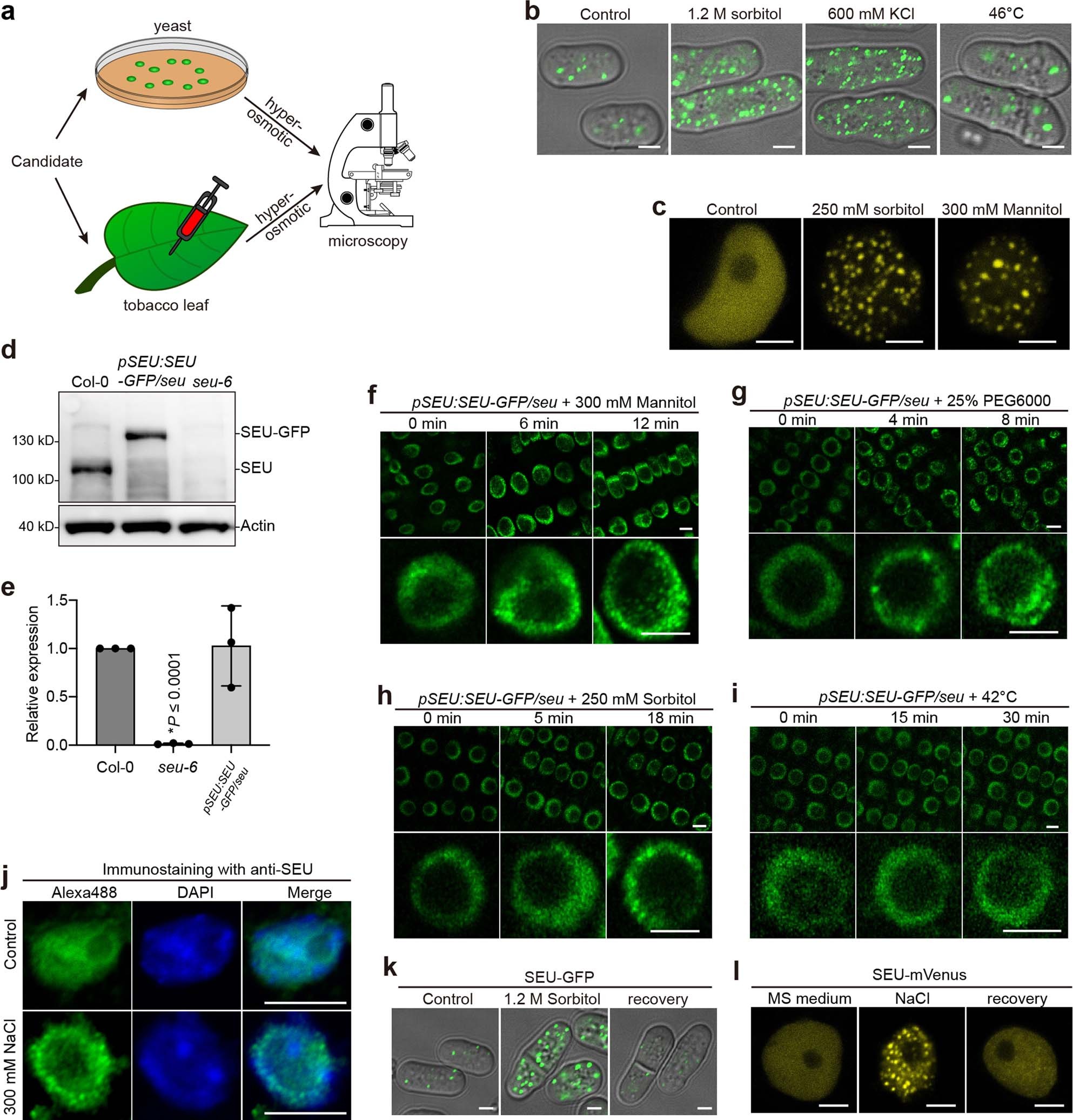 Extended Data Fig. 1: SEU undergoes condensation in response to hyperosmotic stress.