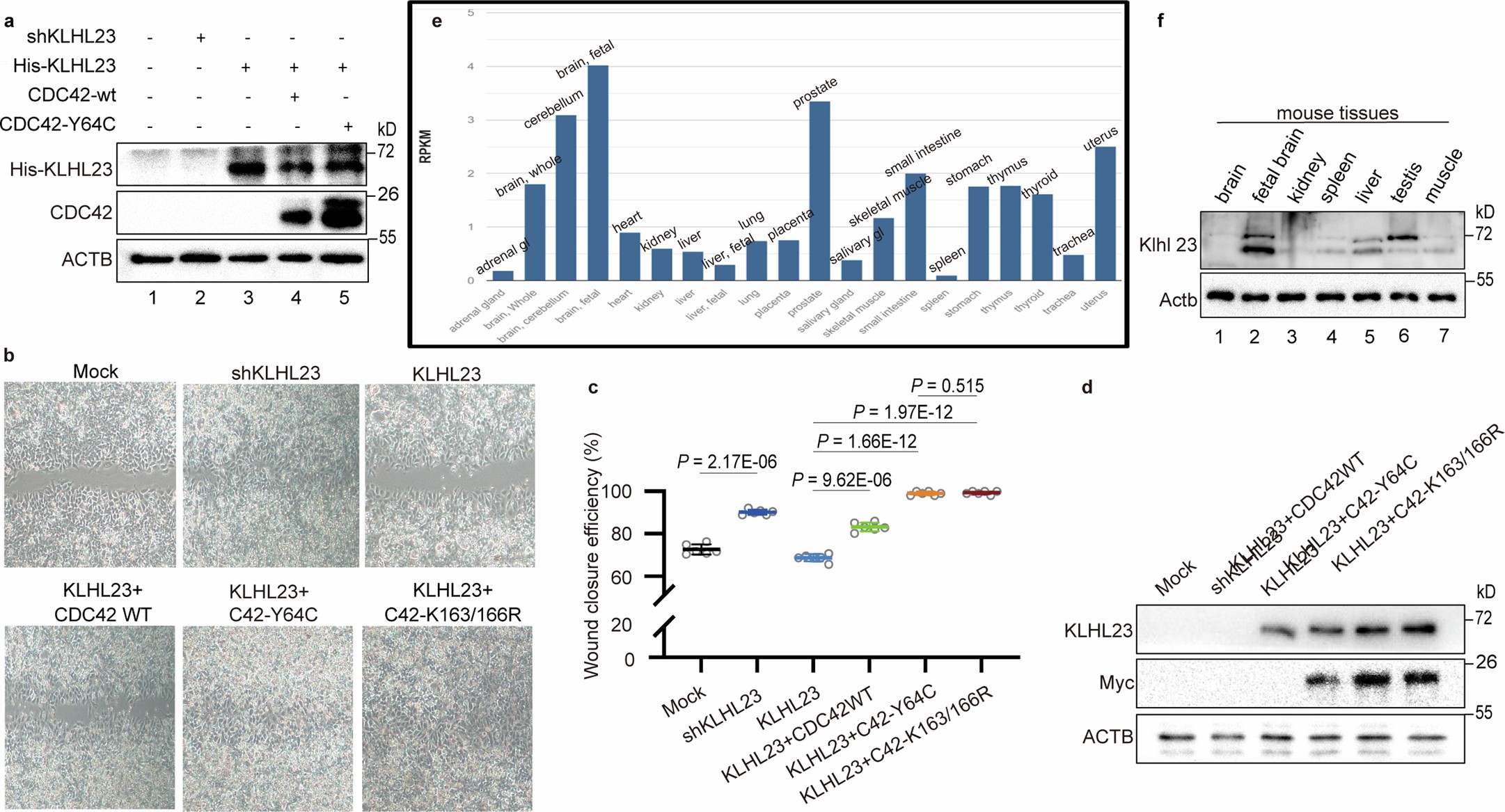 Extended Data Fig. 10: The Y64C-CDC42 variant demonstrates a comparable rescue effect to that of ub-resistant K163R/K166R-CDC42.