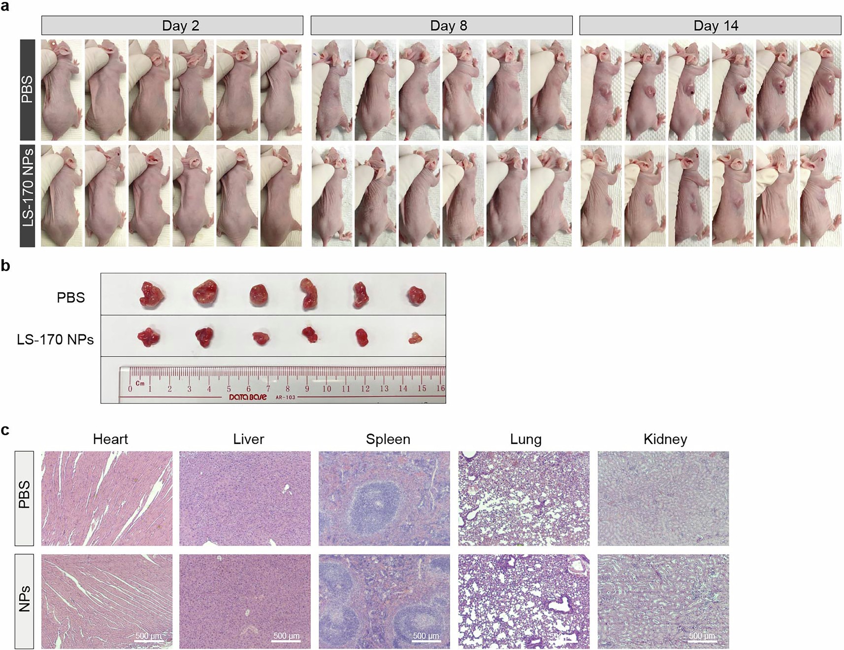 Extended Data Fig. 10: Anti-tumor efficacy of LS-170 NPs in vivo.