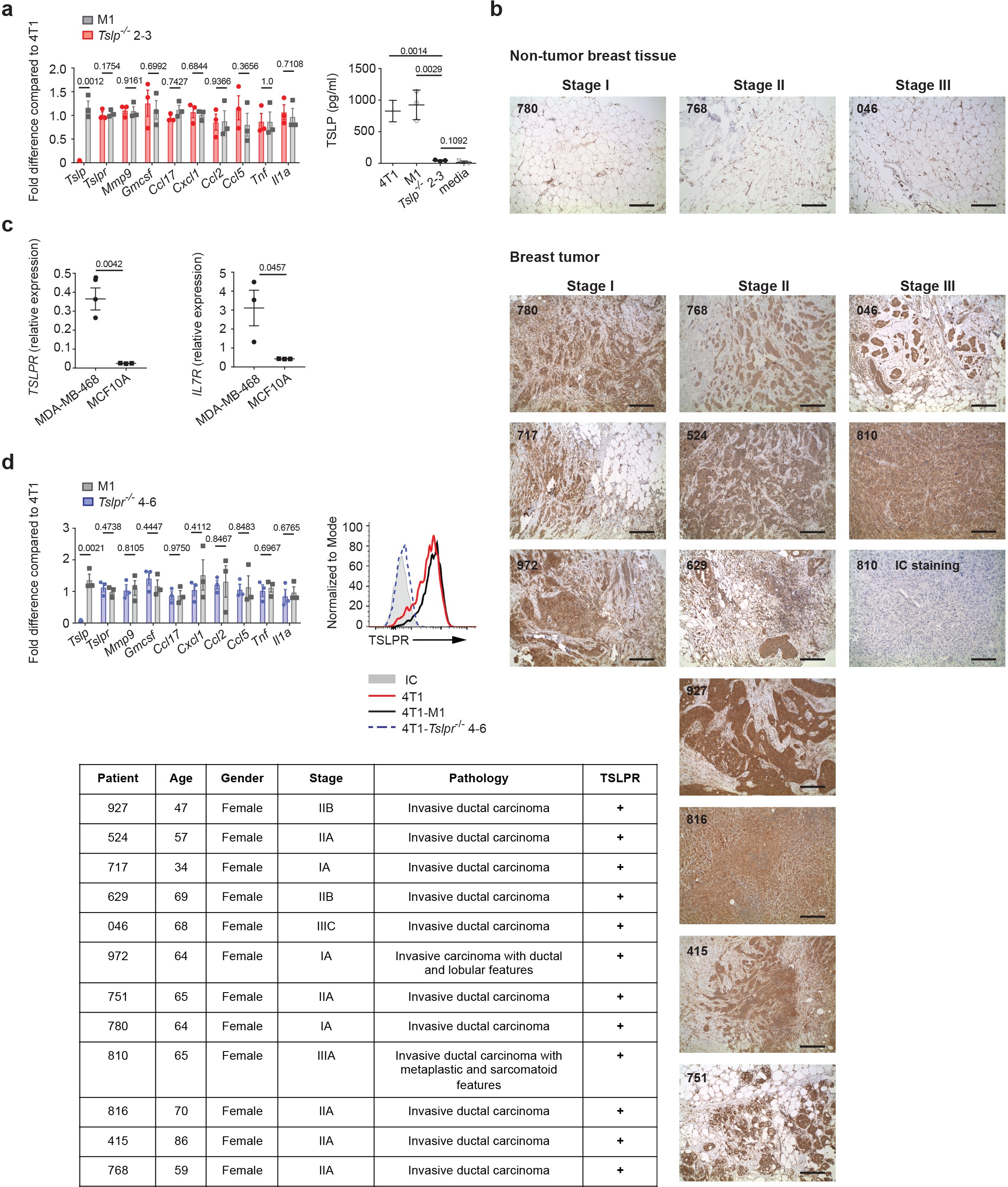 Supplementary Figure 1: Non-tumor breast tissue does not express TSLPR