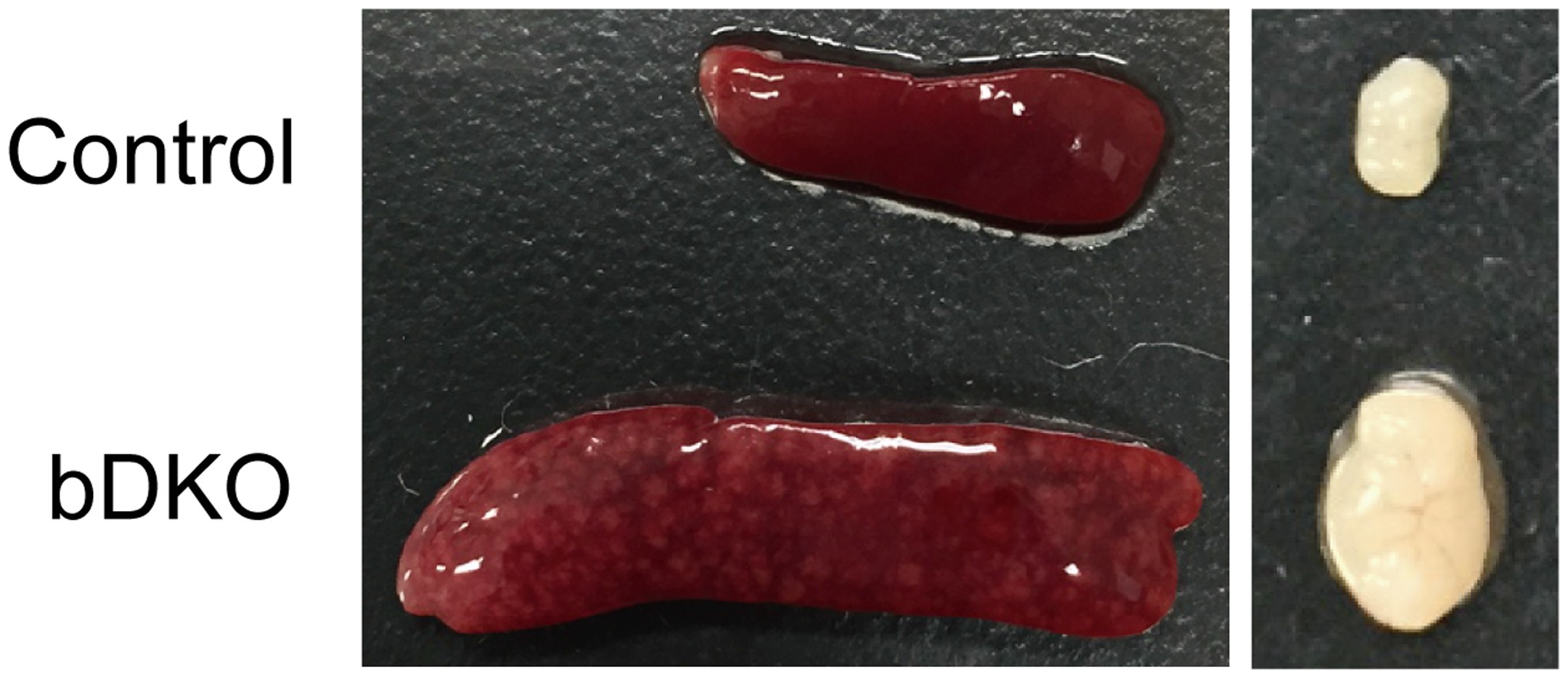 Extended Data Fig. 2: Spleen and lymph nodes of control and bDKO mice.
