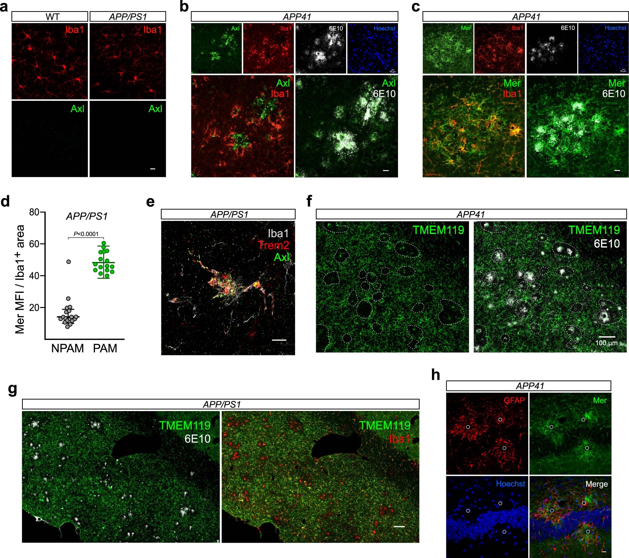 Extended Data Fig. 1: Expression of Axl, Mer, TMEM119, Trem2, and GFAP in plaque-burdened AD brains.