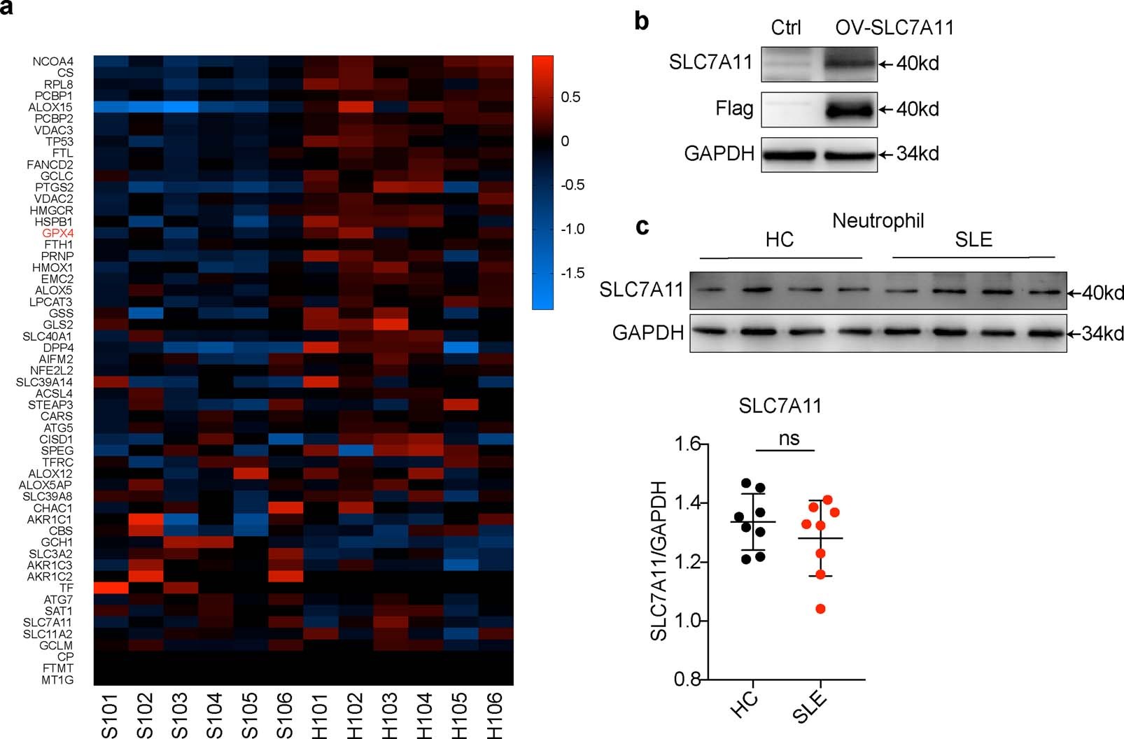 Extended Data Fig. 5: The expression of cystine transporter SLC7A11 is not different between HC and SLE neutrophils.
