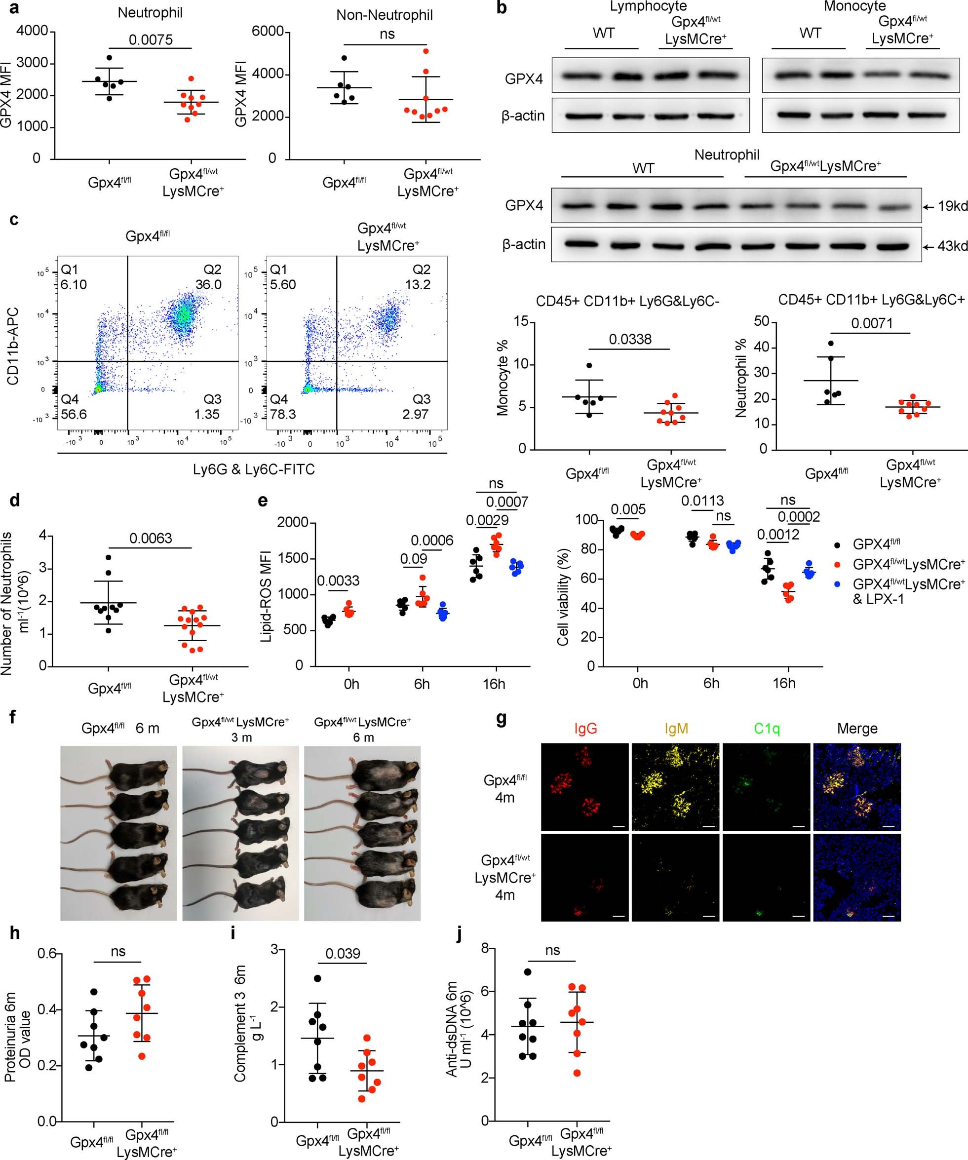 Extended Data Fig. 8: Mice with Gpx4 haploinsufficiency in neutrophils developed spontaneous lupus-like disease, while Gpx4 fl/flLysMCre+ mice exhibited mild autoimmunity.