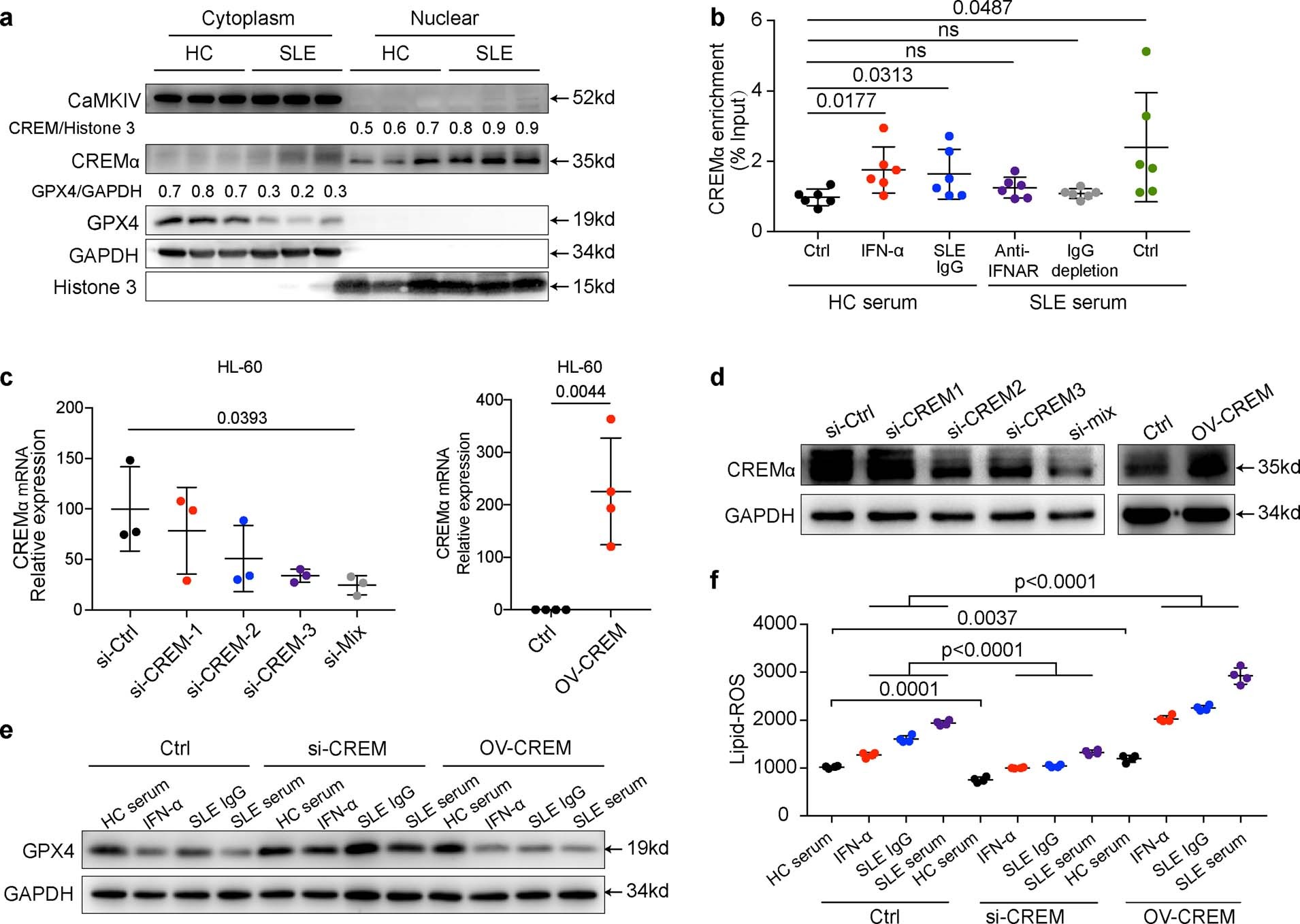 Extended Data Fig. 9: IFNα and SLE IgG enhanced ferroptosis by promoting binding of CREM to the Gpx4 promoter.