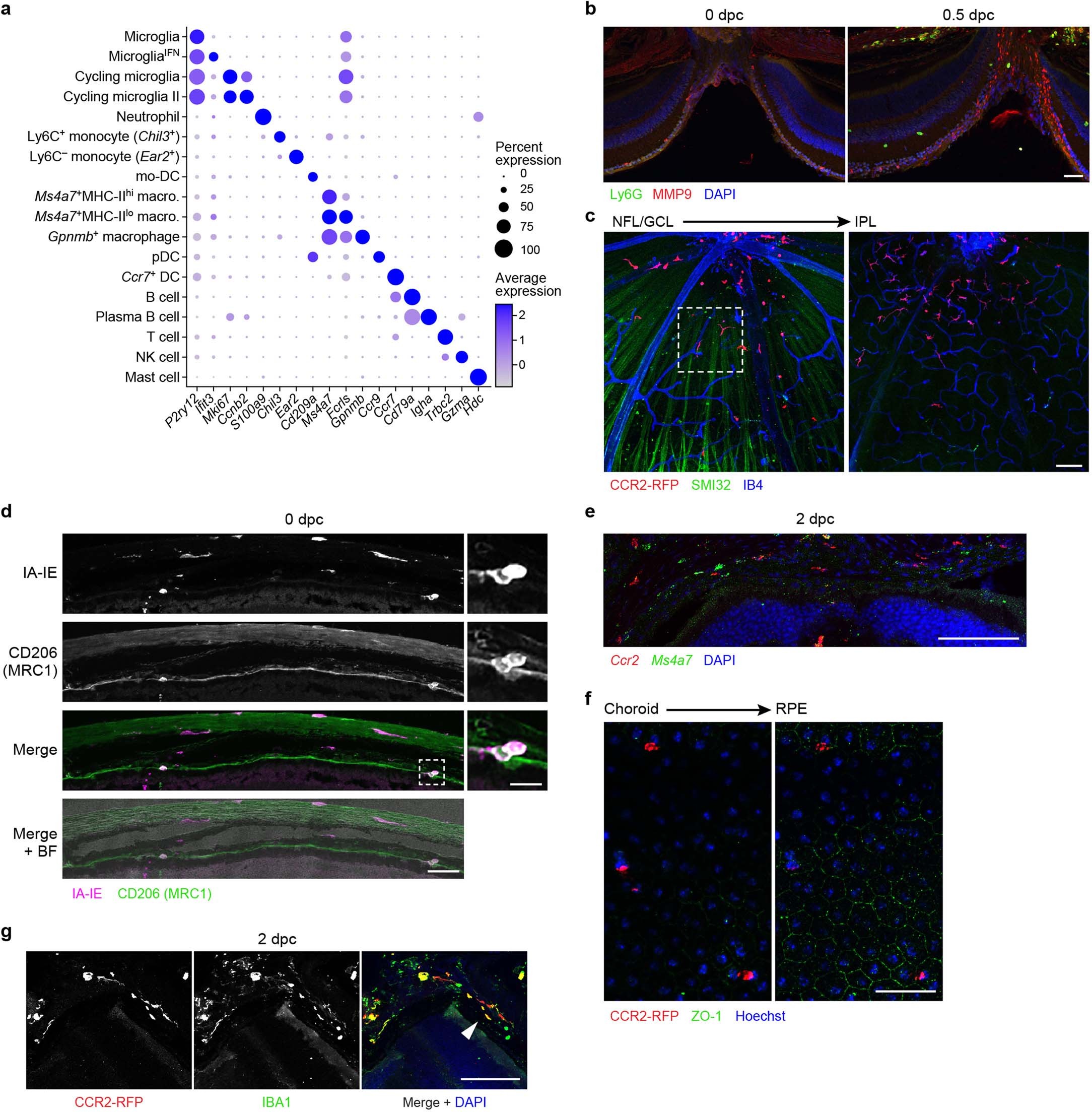 Extended Data Fig. 3: Visualizing immune cells in the retina and eyecup.