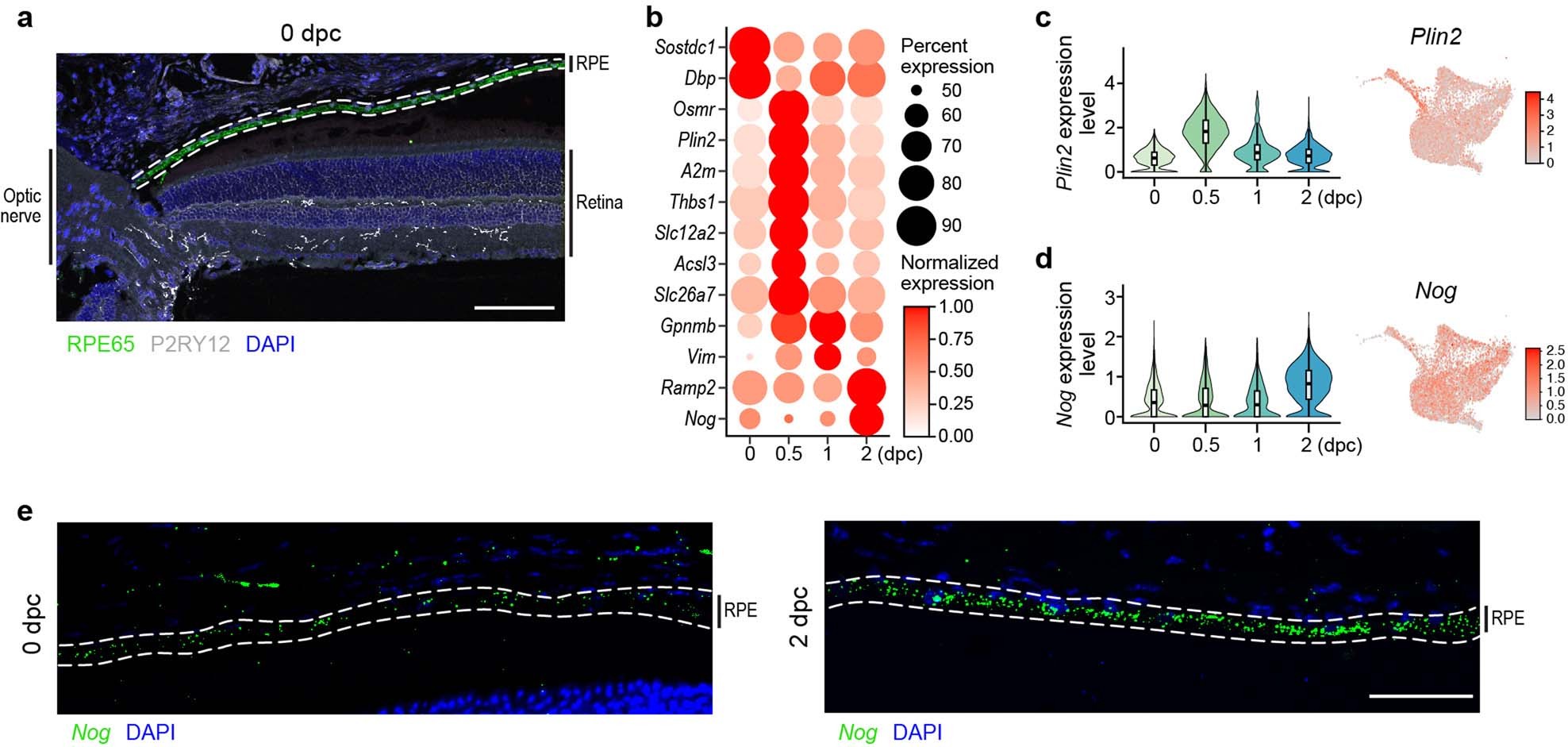 Extended Data Fig. 5: ONC-induced expression changes in the RPE.