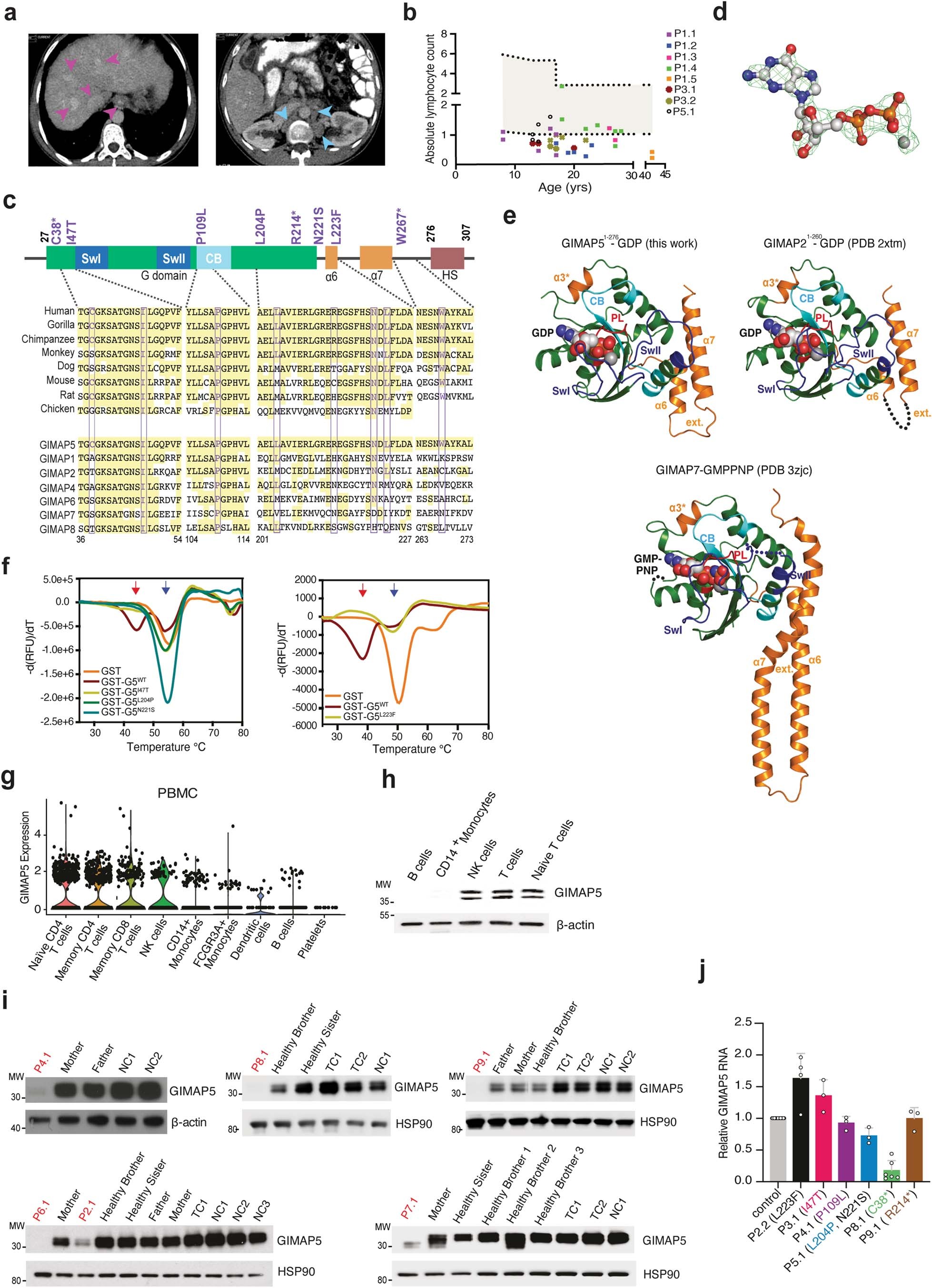 Extended Data Fig. 1: GIMAP5 mutations cause protein destabilization in patients’ T cells.