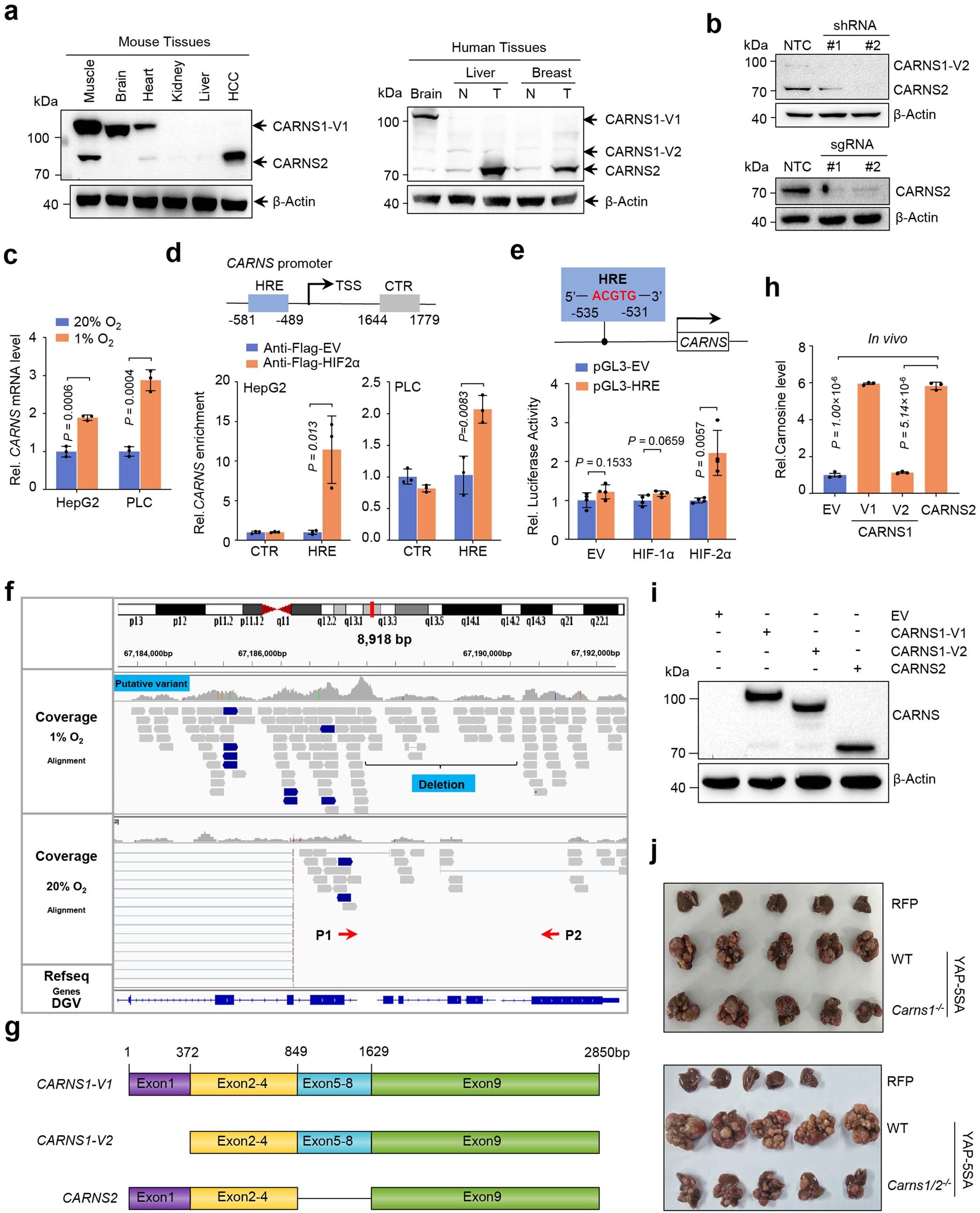 Extended Data Fig. 2: Hypoxia promotes the expression of CARNS2, which can facilitate tumor progression.