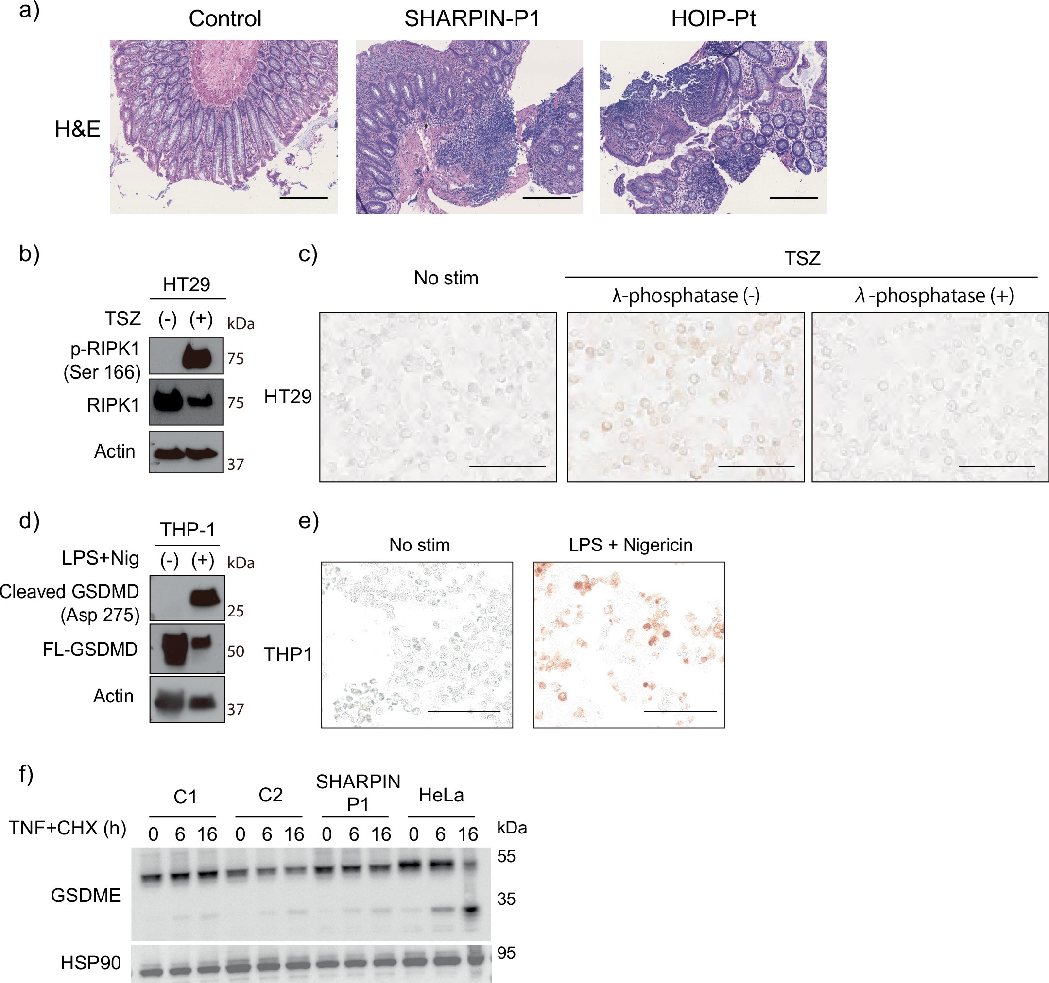 Extended Data Fig. 4: In vivo and in vitro characterization of cell death in human LUBAC deficiency.