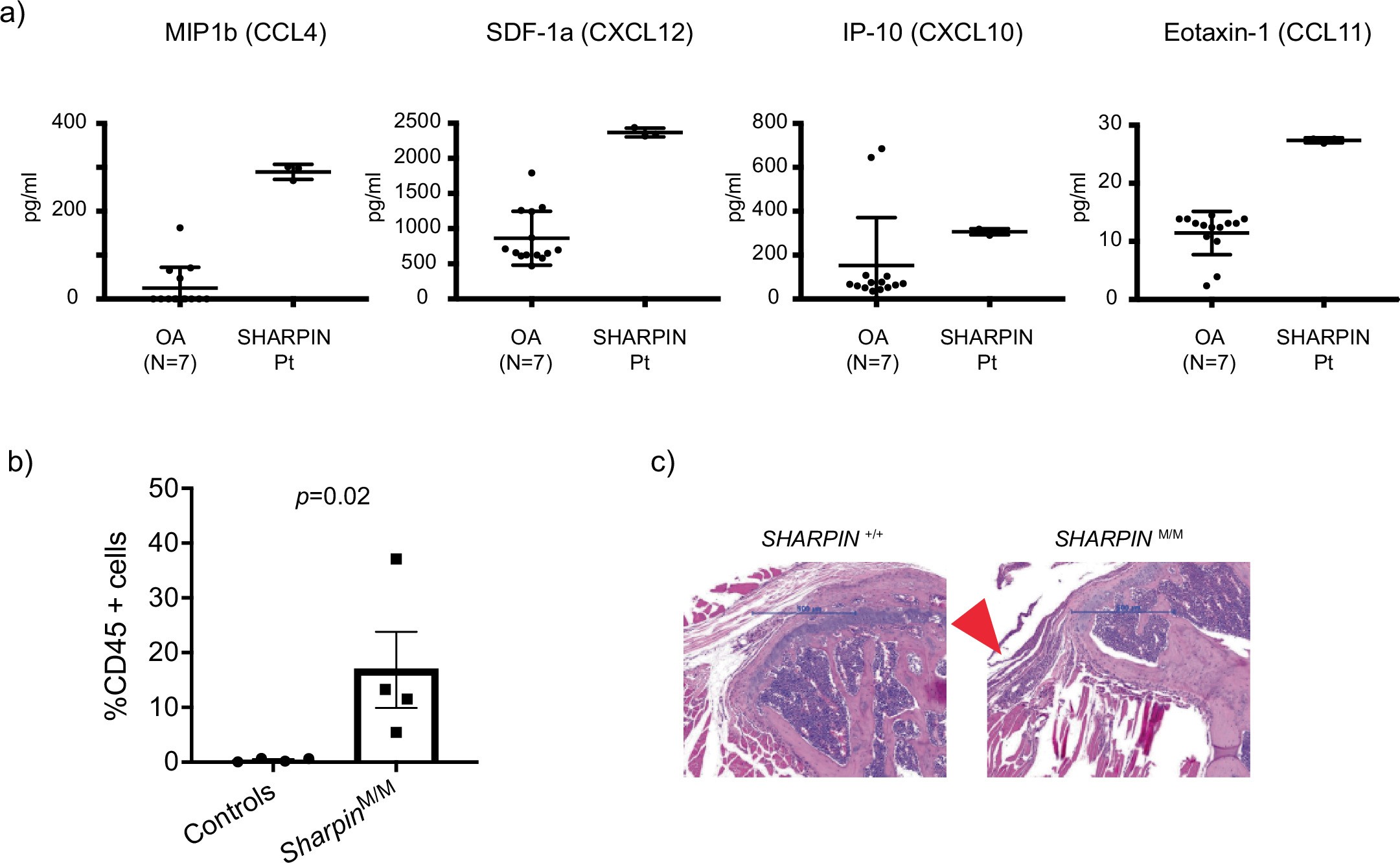 Extended Data Fig. 5: Characterization of joint inflammation in SHARPIN deficiency.