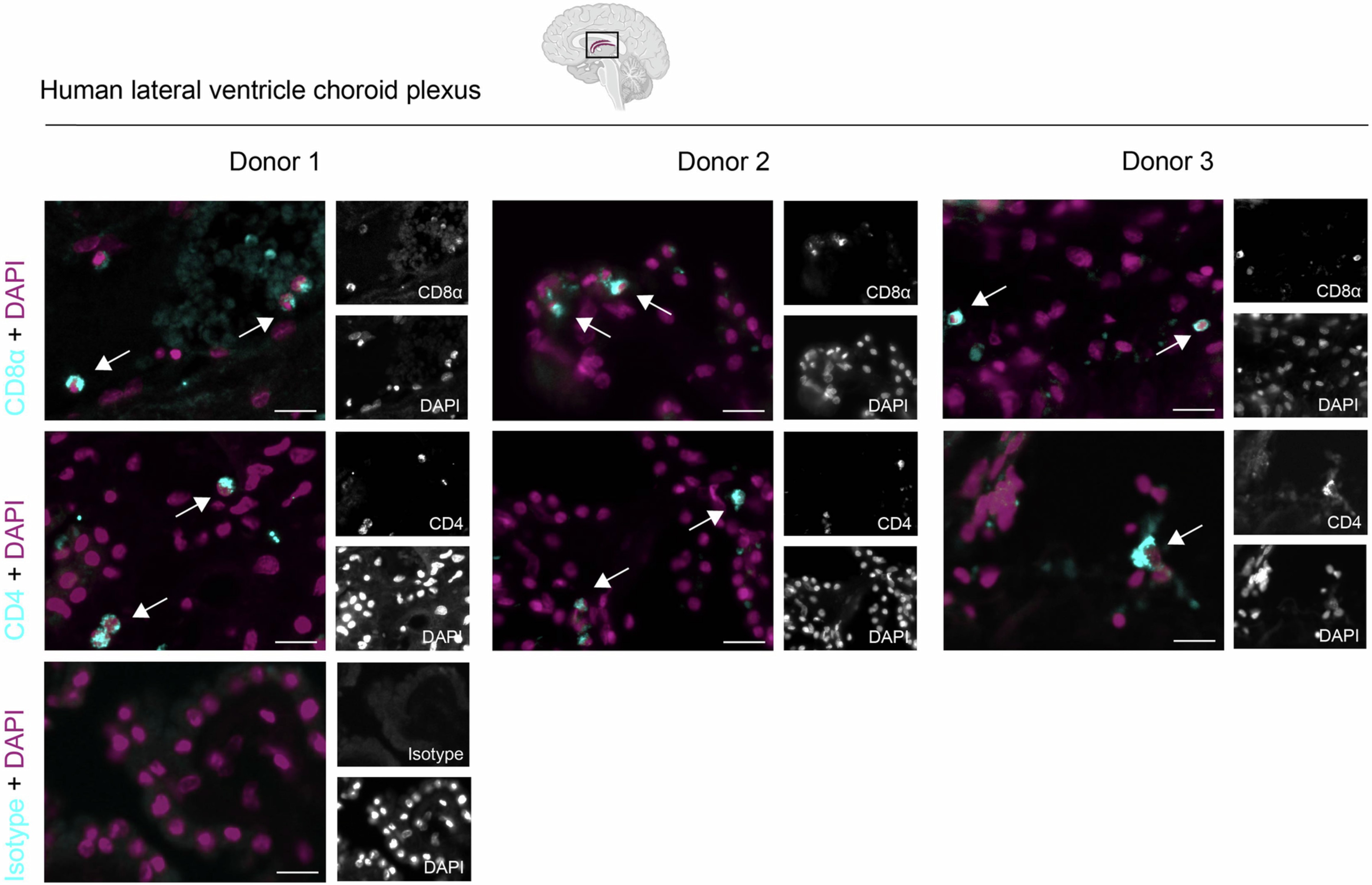 Extended Data Fig. 5: The human choroid plexus harbors CD8+ and CD4+ T cells.