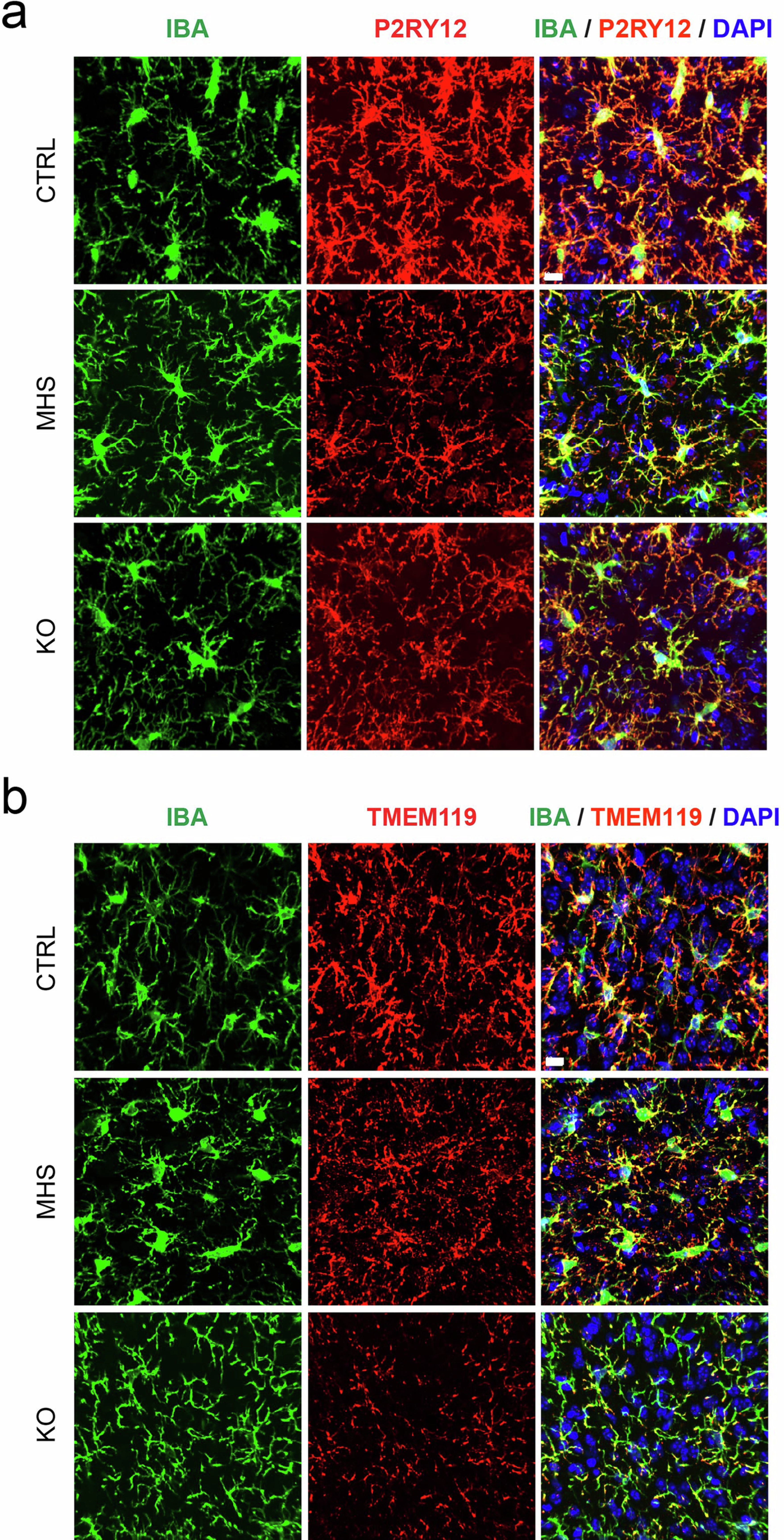 Extended Data Fig. 10: Xeno-transplanted microglia express canonical microglial markers despite loss of MEF2C.