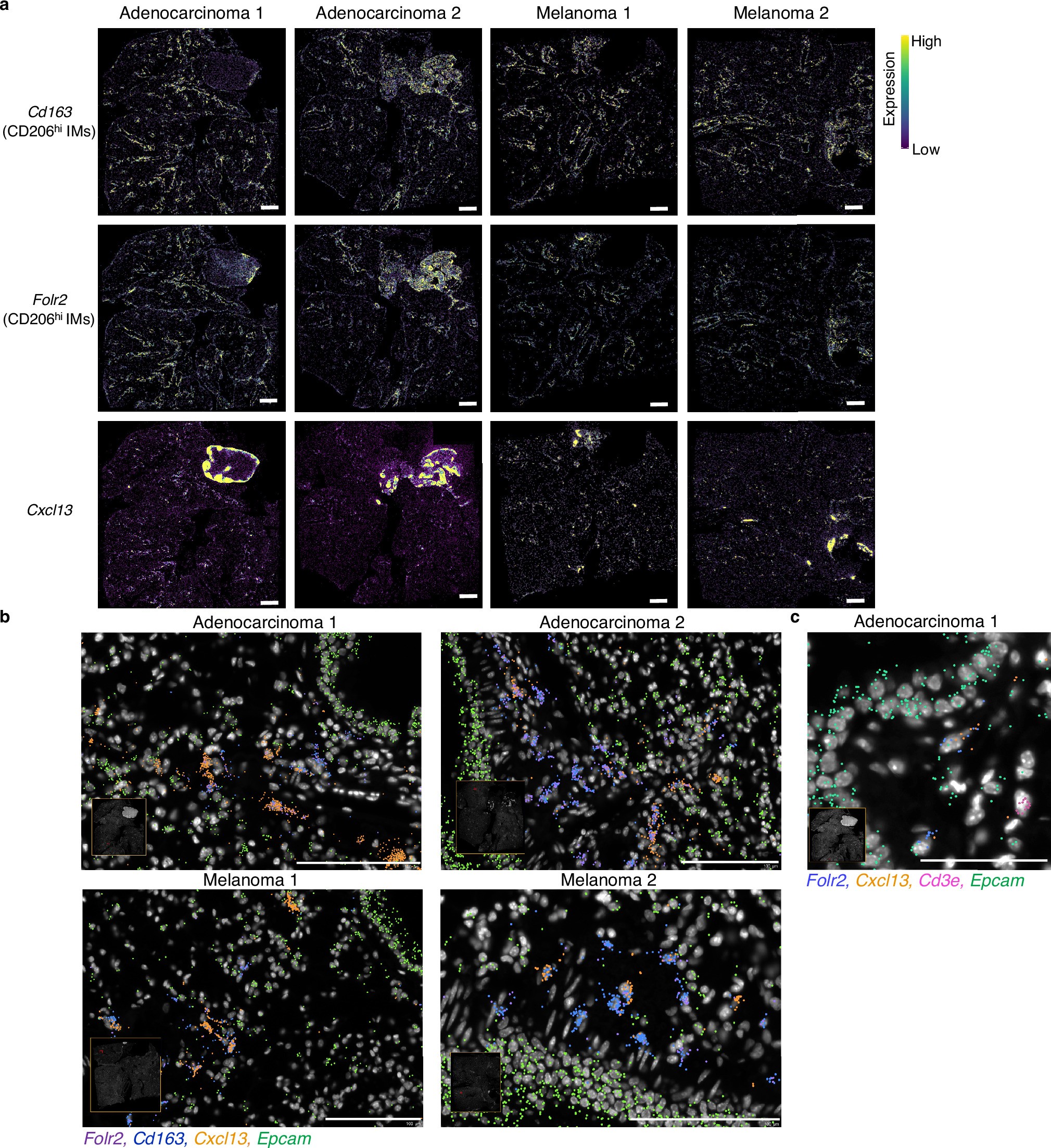 Extended Data Fig. 5: Spatial transcriptomic visualization of Cxcl13 expression in CD206hi IMs in lung adenocarcinoma and melanoma.