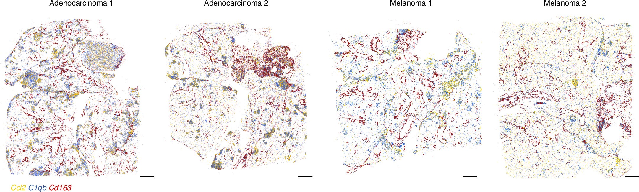 Extended Data Fig. 6: Ccl2 expression in the TME.