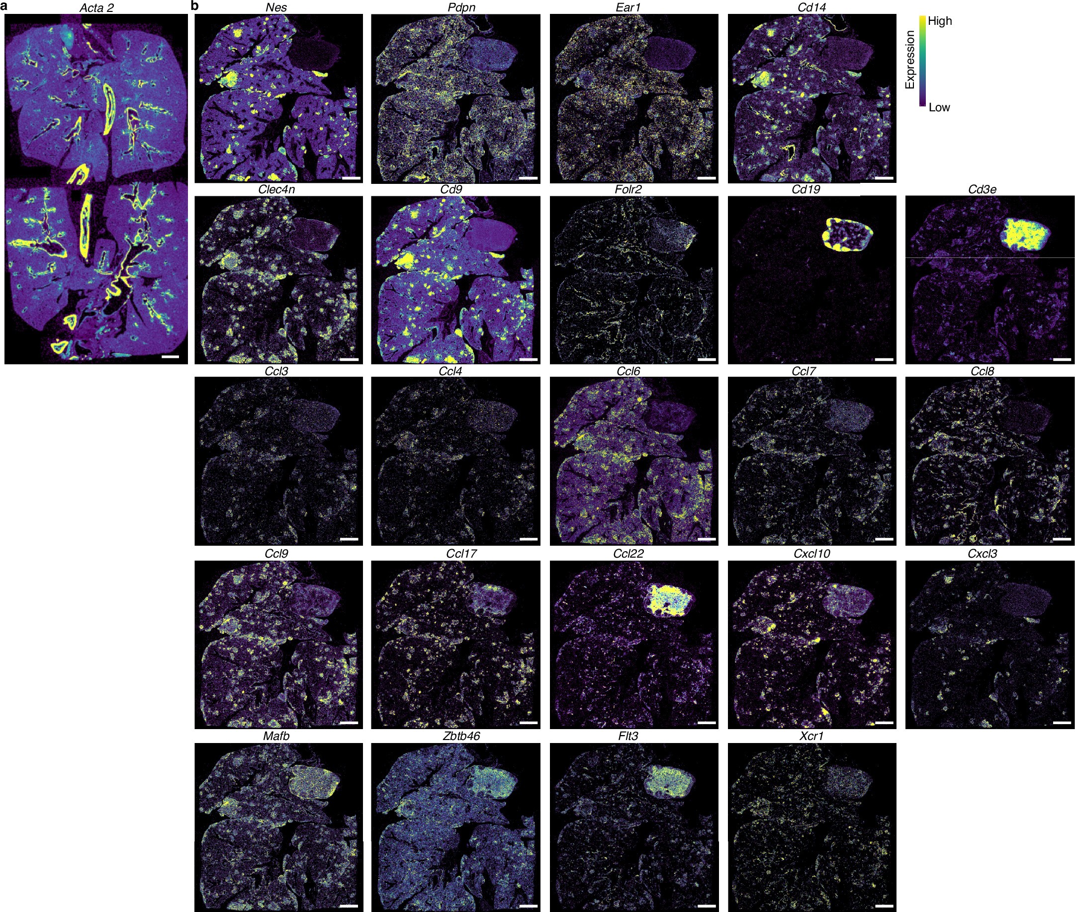 Extended Data Fig. 3: Spatial transcriptomics reveals abundant recMacs and IMs with distinct chemokine programs in lung adenocarcinoma.