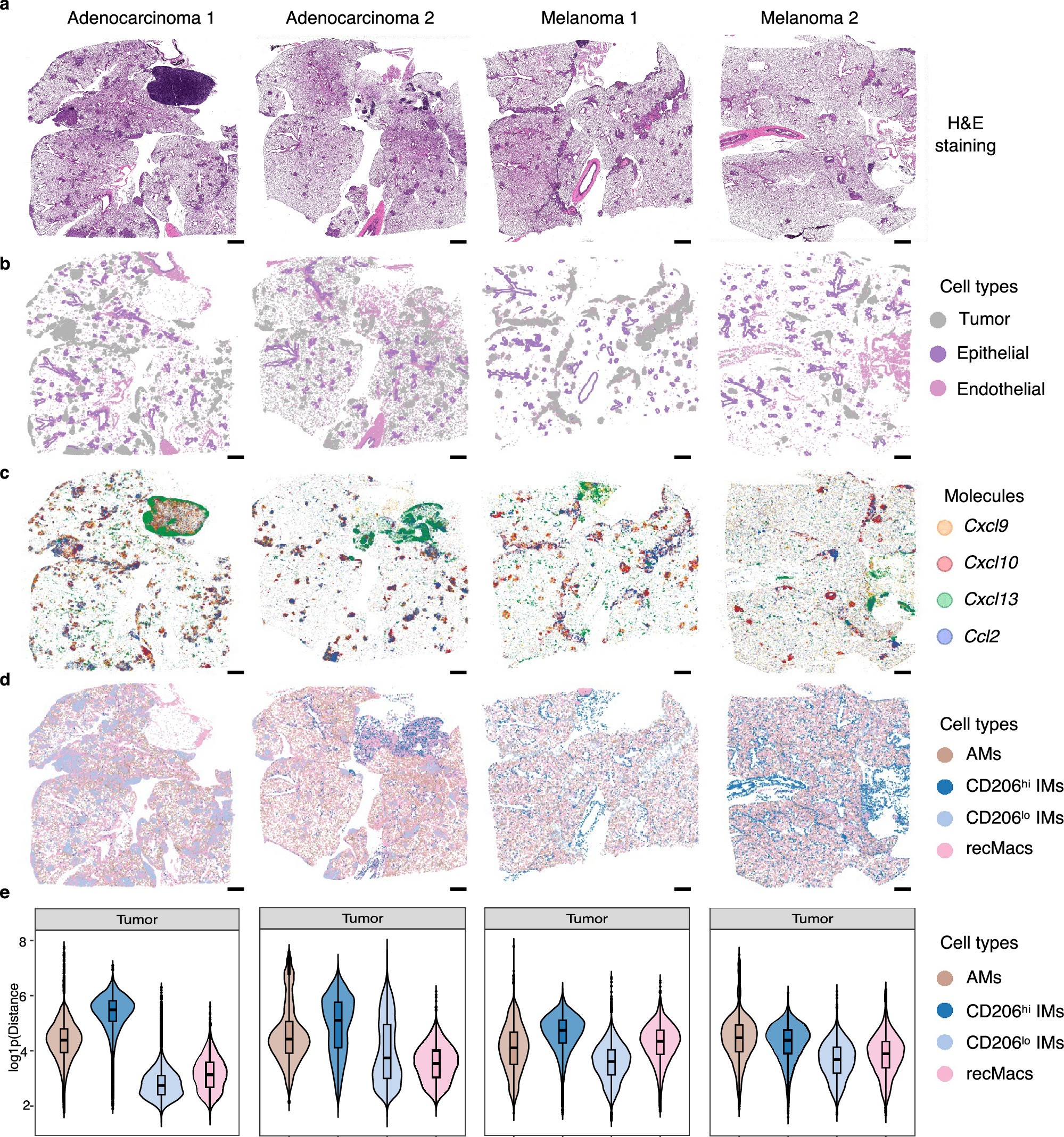 Extended Data Fig. 4: Xenium spatial transcriptomic mapping of macrophages and chemokine co-localization.