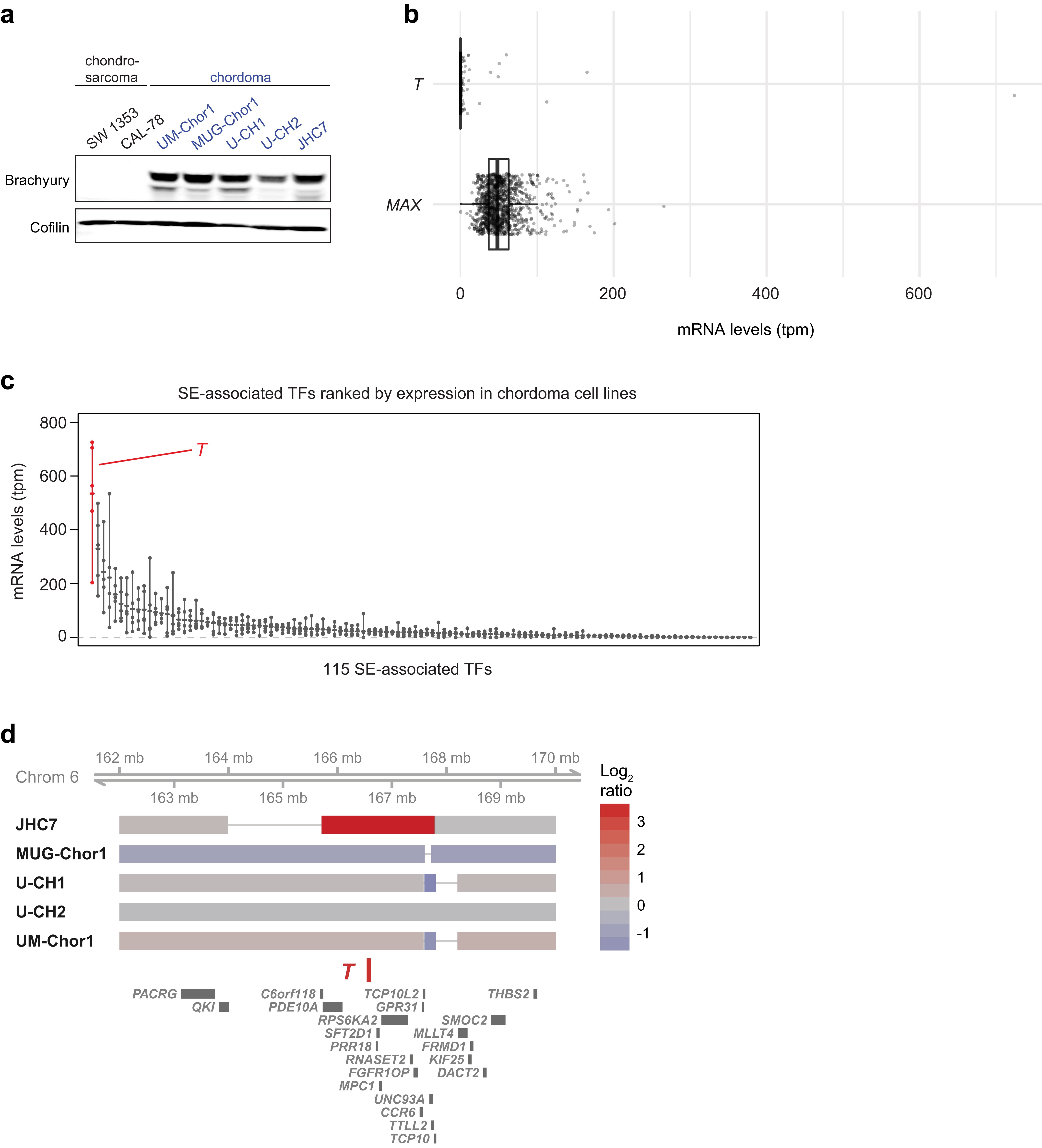 Extended Data Fig. 5: Brachyury is highly expressed in chordoma cell lines.