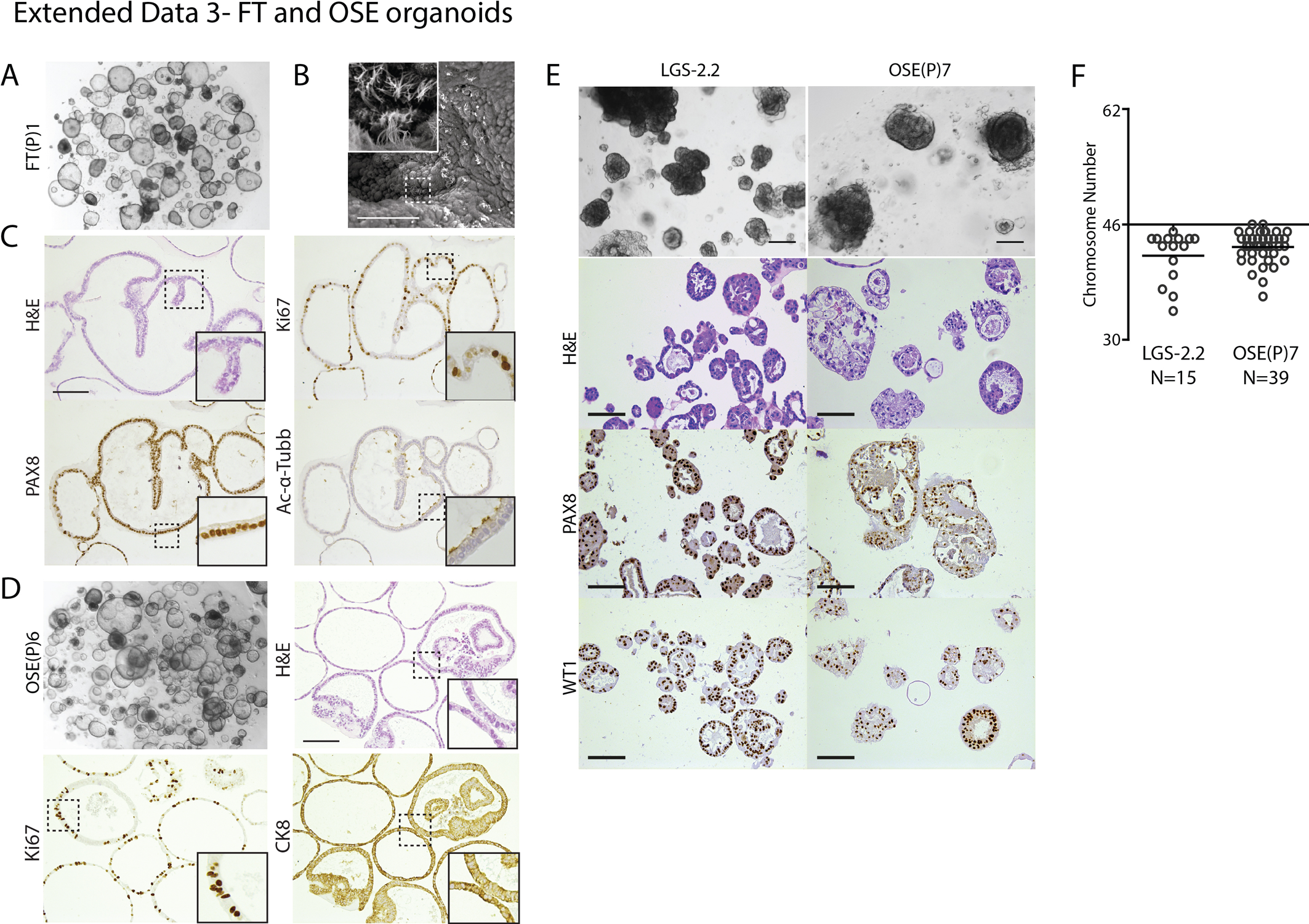 Extended Data Fig. 3: FT and OSE organoids.