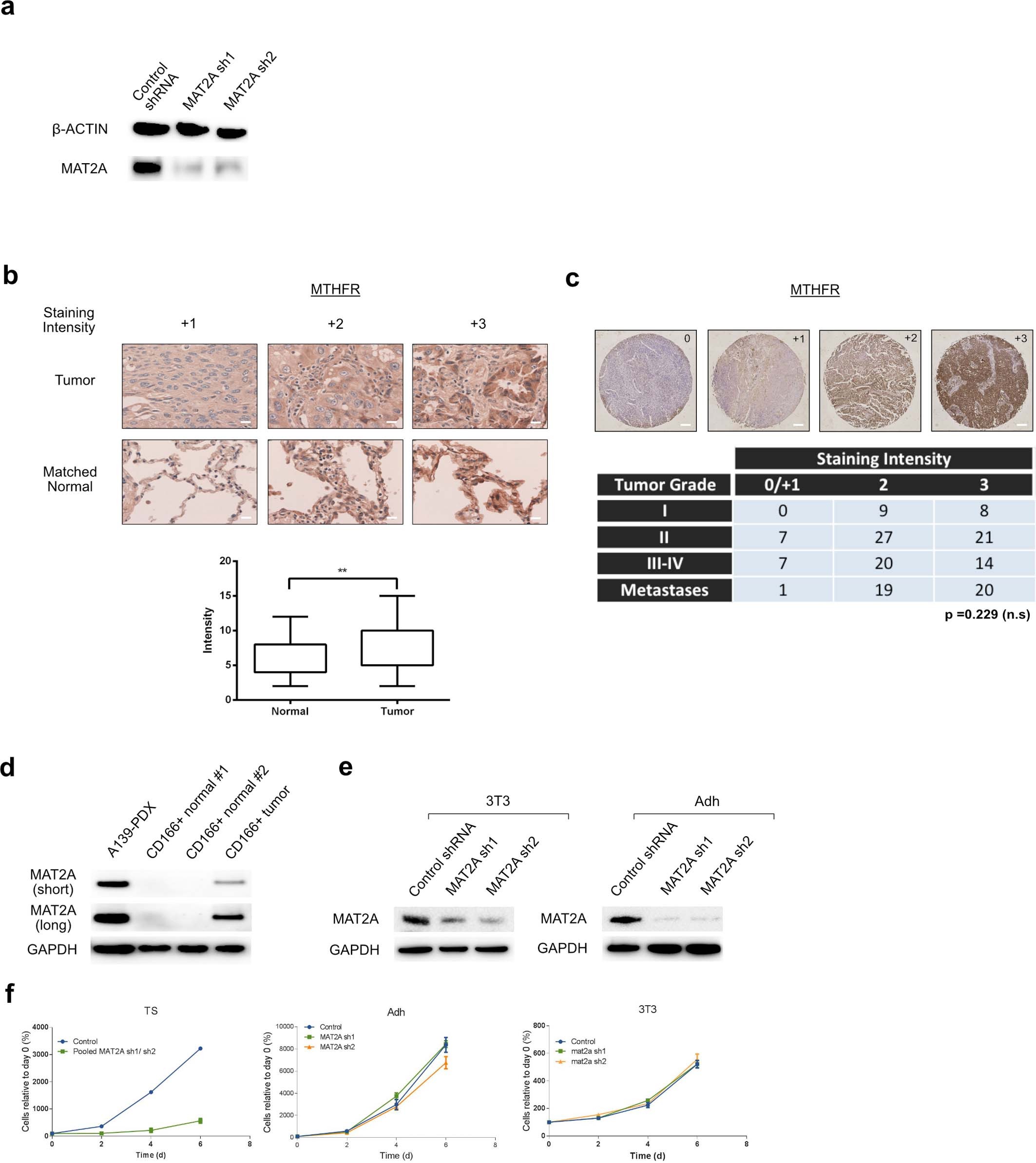 Extended Data Fig. 4: Functional and clinical relevance of methionine cycle enzymes in NSCLC.