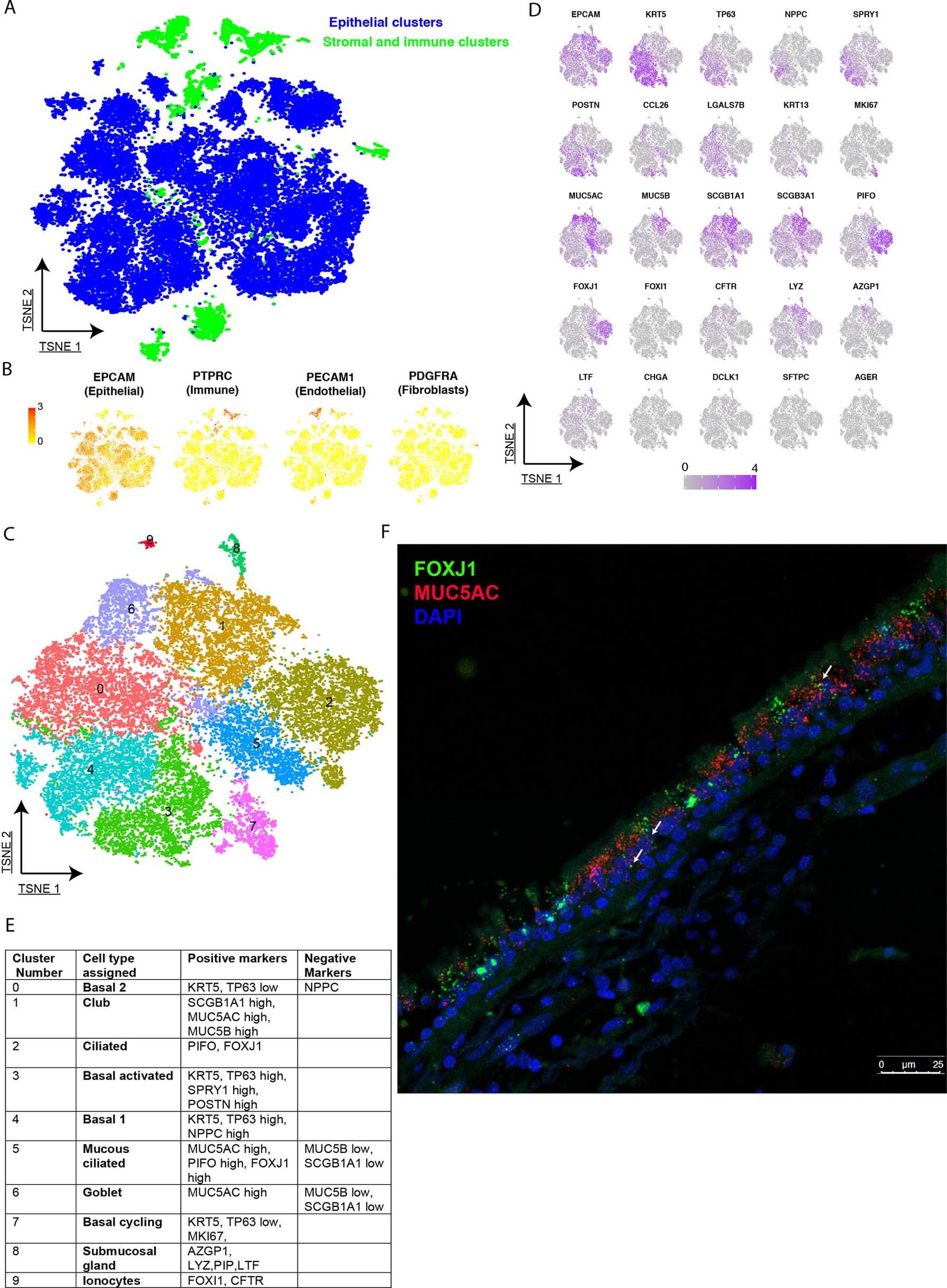 Extended Data Fig. 6: Unbiased clustering of lower airway biopsy samples of healthy volunteers and volunteers with asthma and the strategy used to divide the dataset depicted in Fig. 3.
