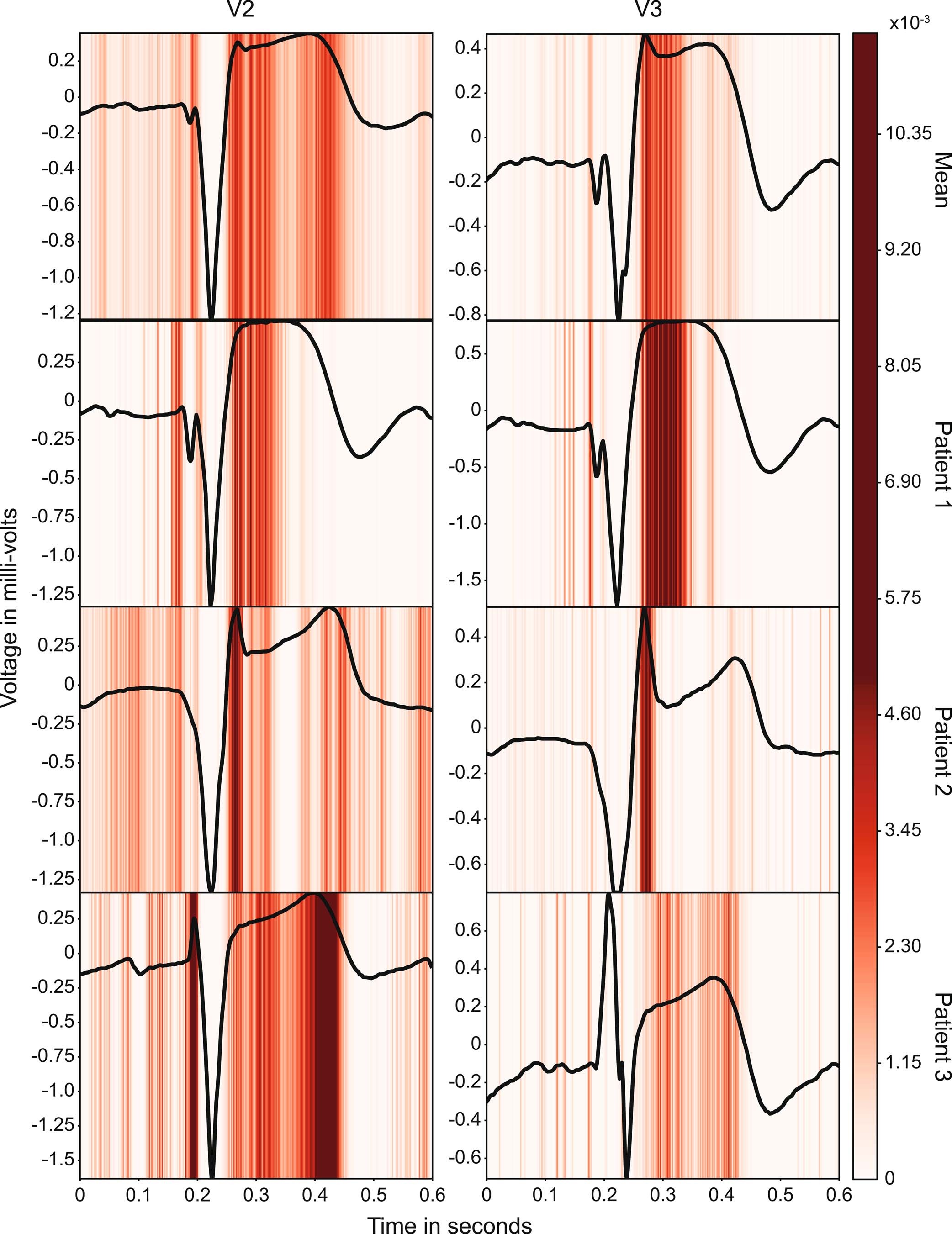 Extended Data Fig. 4: Model explainability with GRAD-CAM.