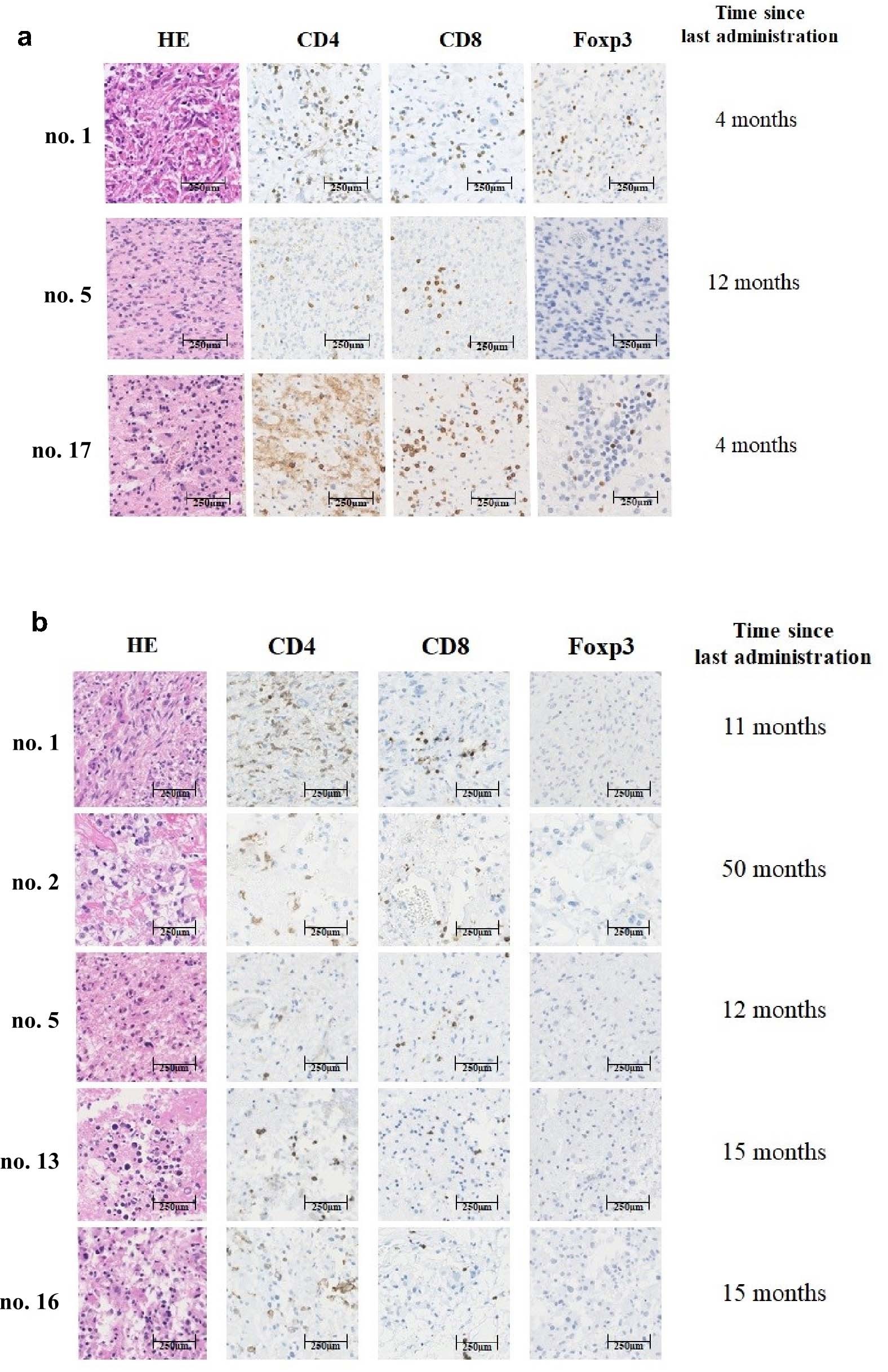 Extended Data Fig. 8: Histology of regrown tumors at reoperation and brain lesions at autopsy.