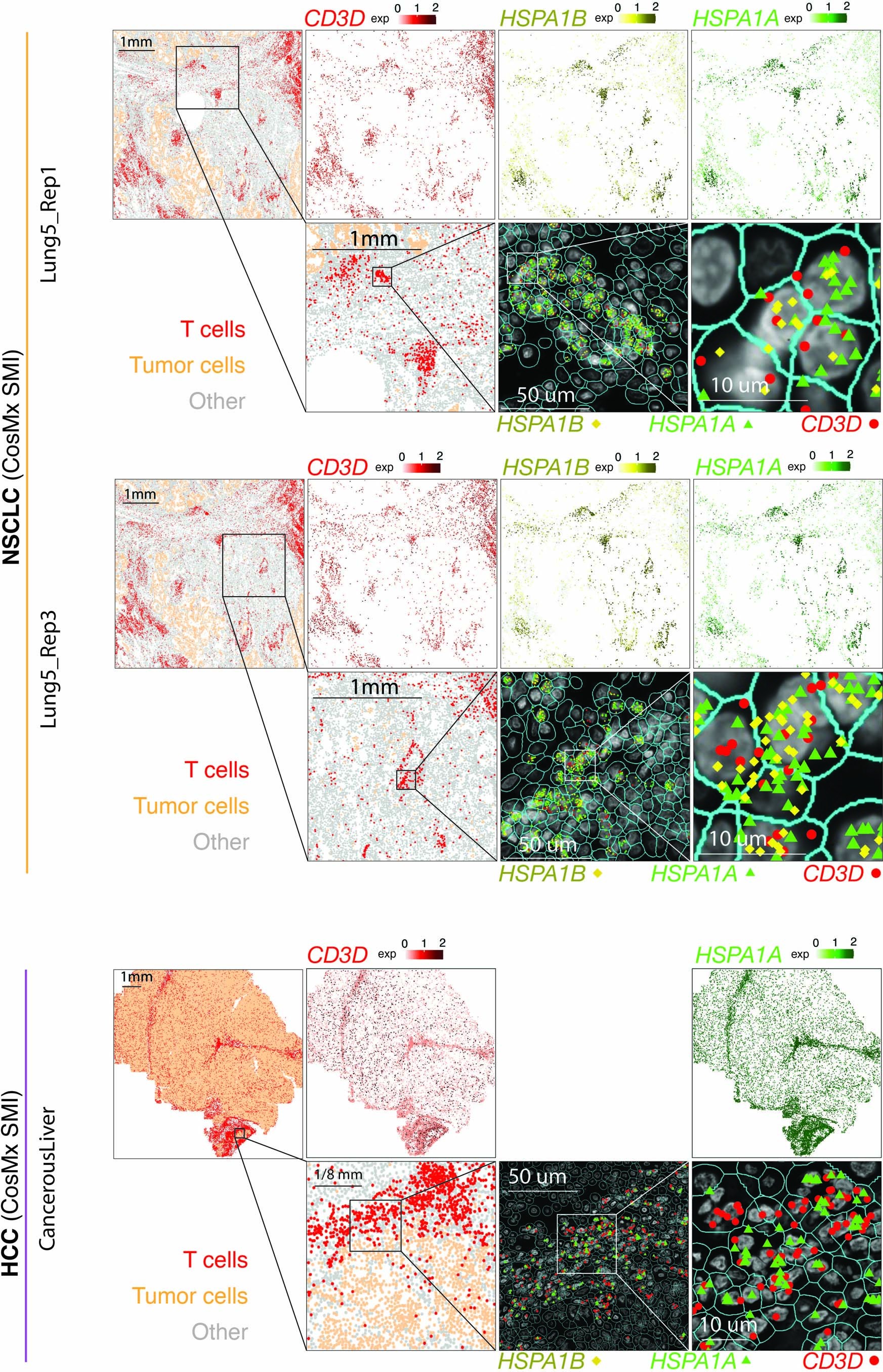 Extended Data Fig. 7: Detection of in situ HSPA1A and HSPA1B expression in tumor-infiltrating T cells in NSCLC and HCC samples by CosMx.