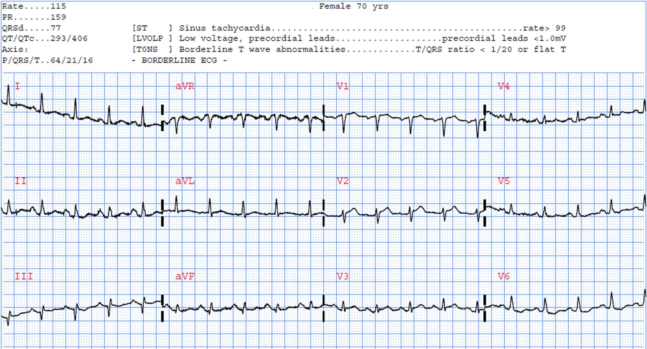Extended Data Fig. 5