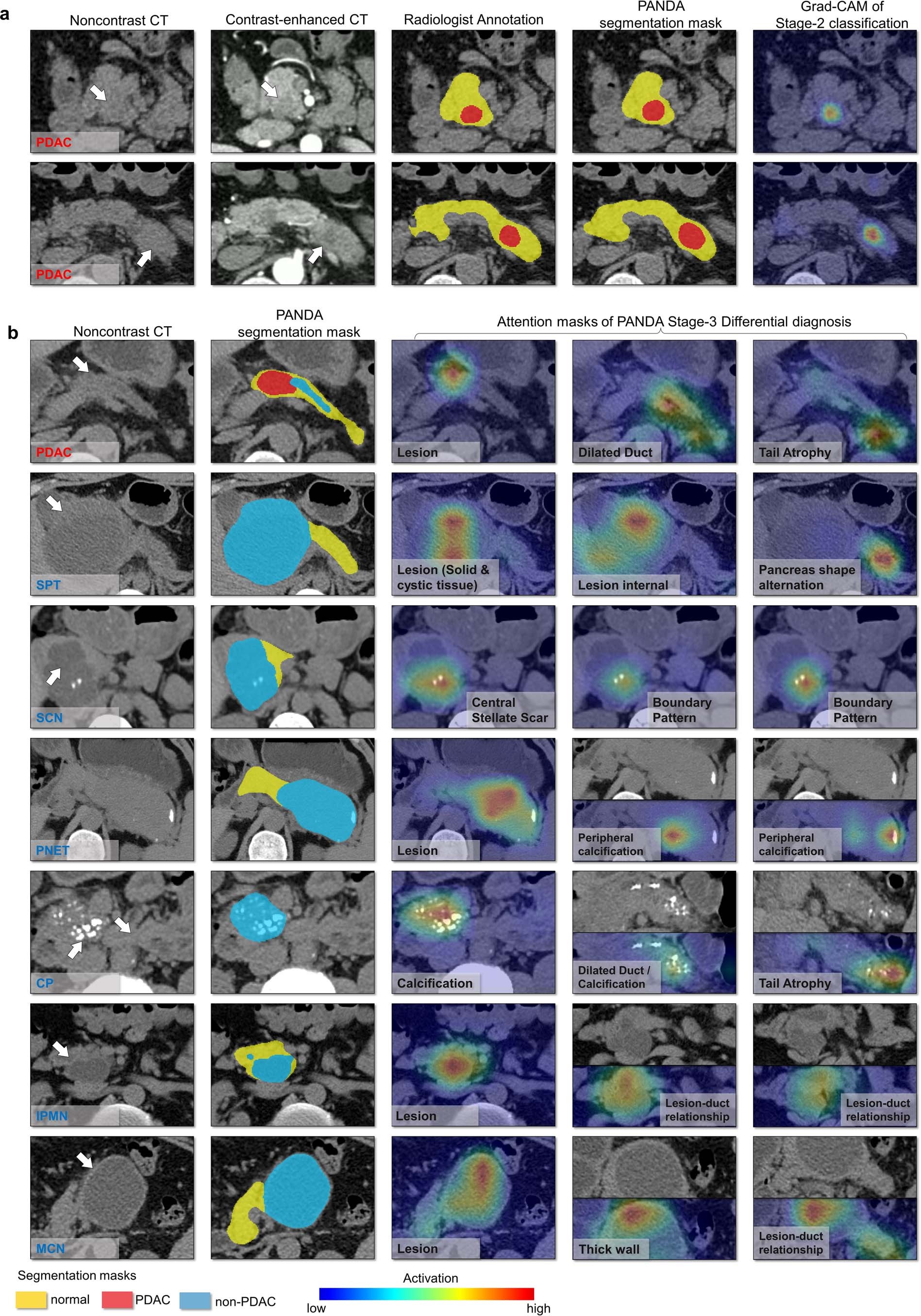 Extended Data Fig. 4: Analysis of interpretability.
