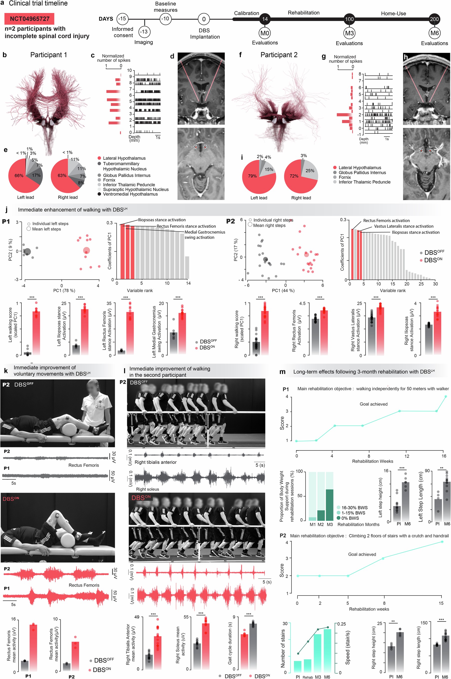 Extended Data Fig. 10: DBSLH in two incomplete SCI individuals leads to immediate and durable improvements in walking.