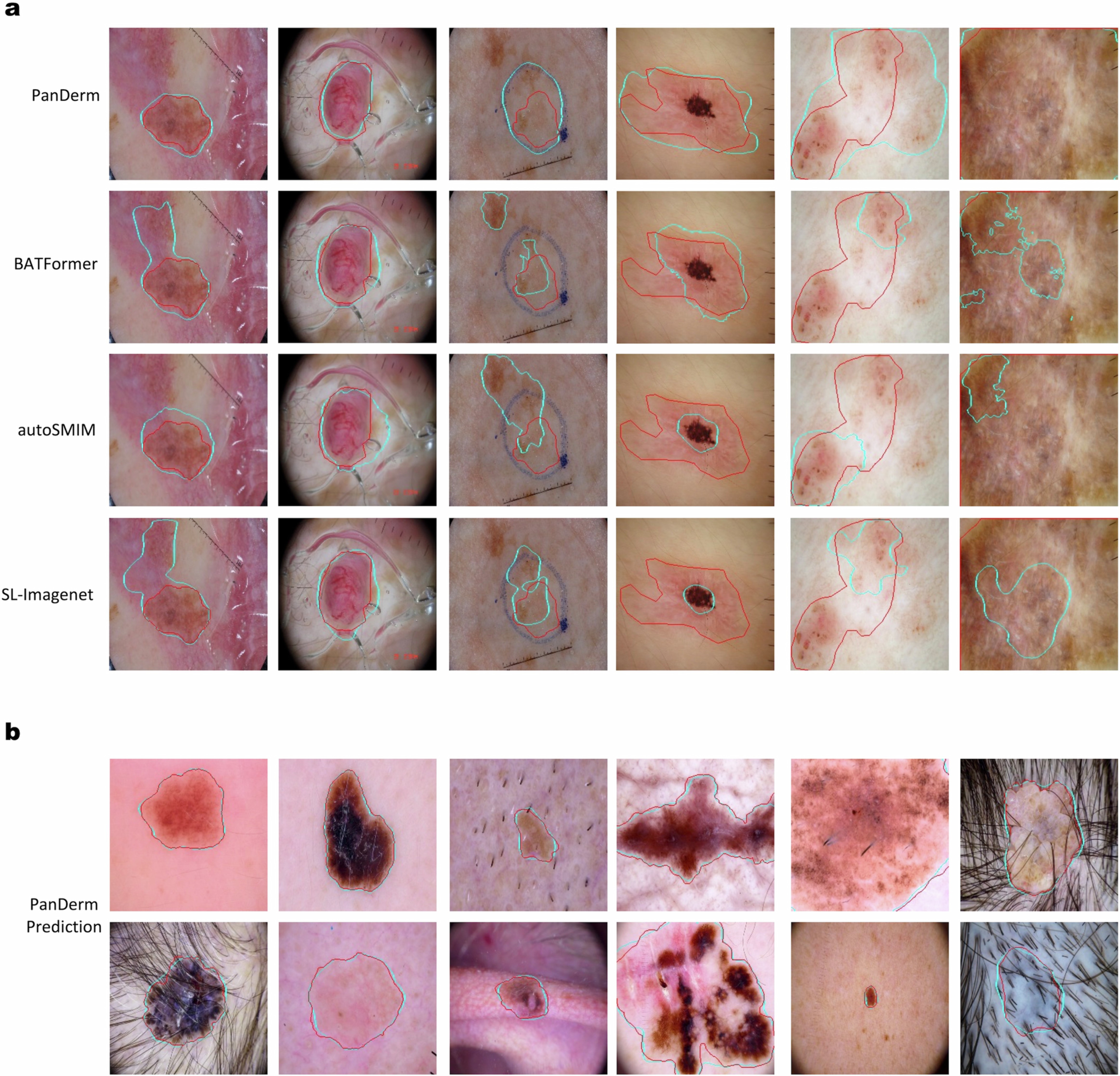 Extended Data Fig. 6: Qualitative skin lesion segmentation results.
