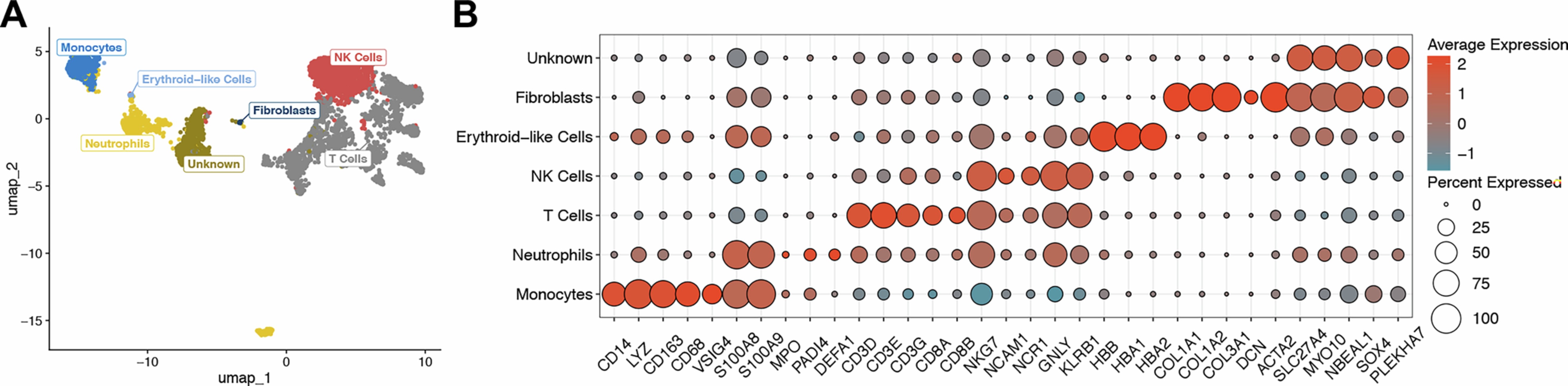 Extended Data Fig. 3: Identification of infiltrated human cells in porcine liver.