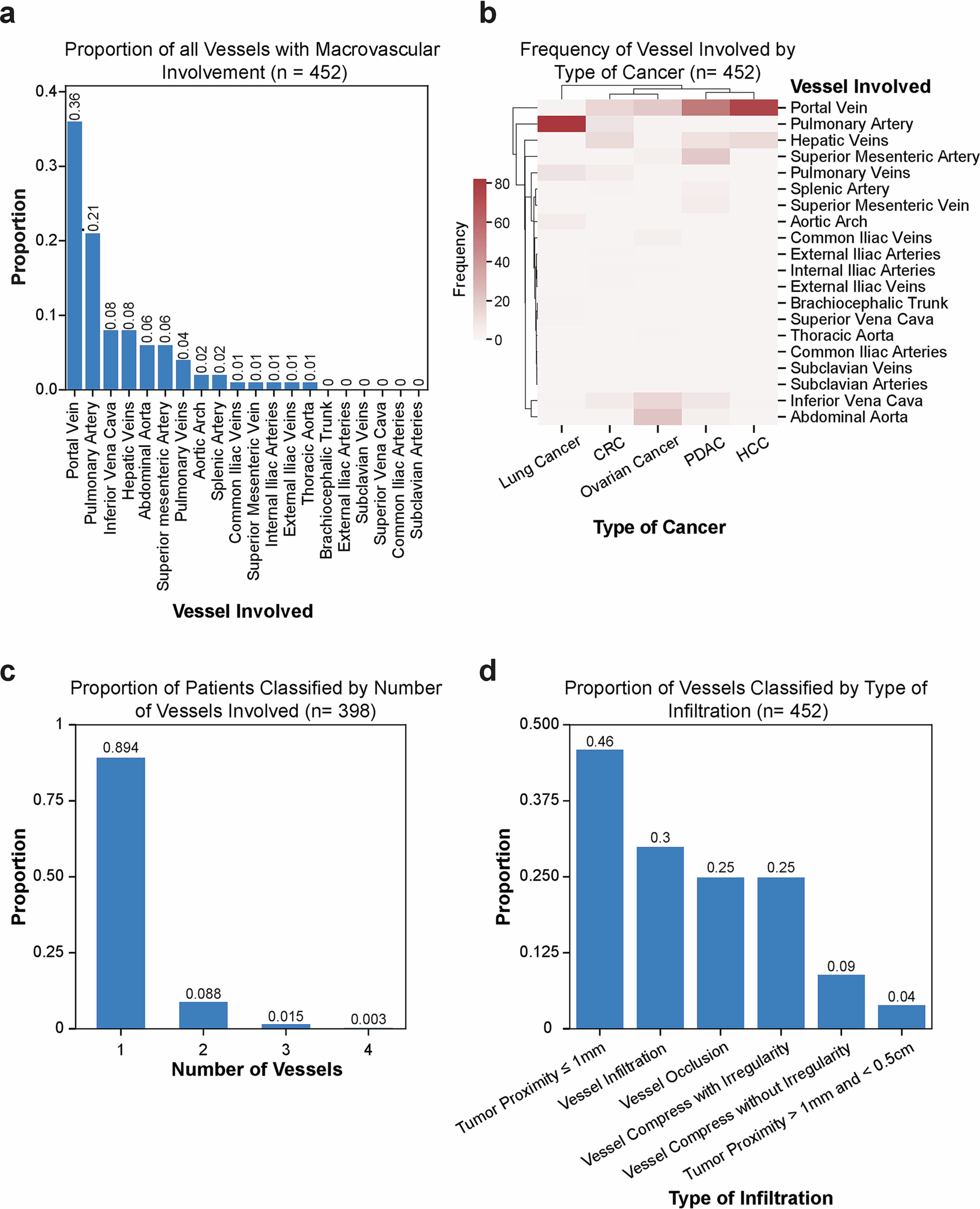 Extended Data Fig. 8: Characteristics of macrovascular infiltration in the German retrospective cohort.