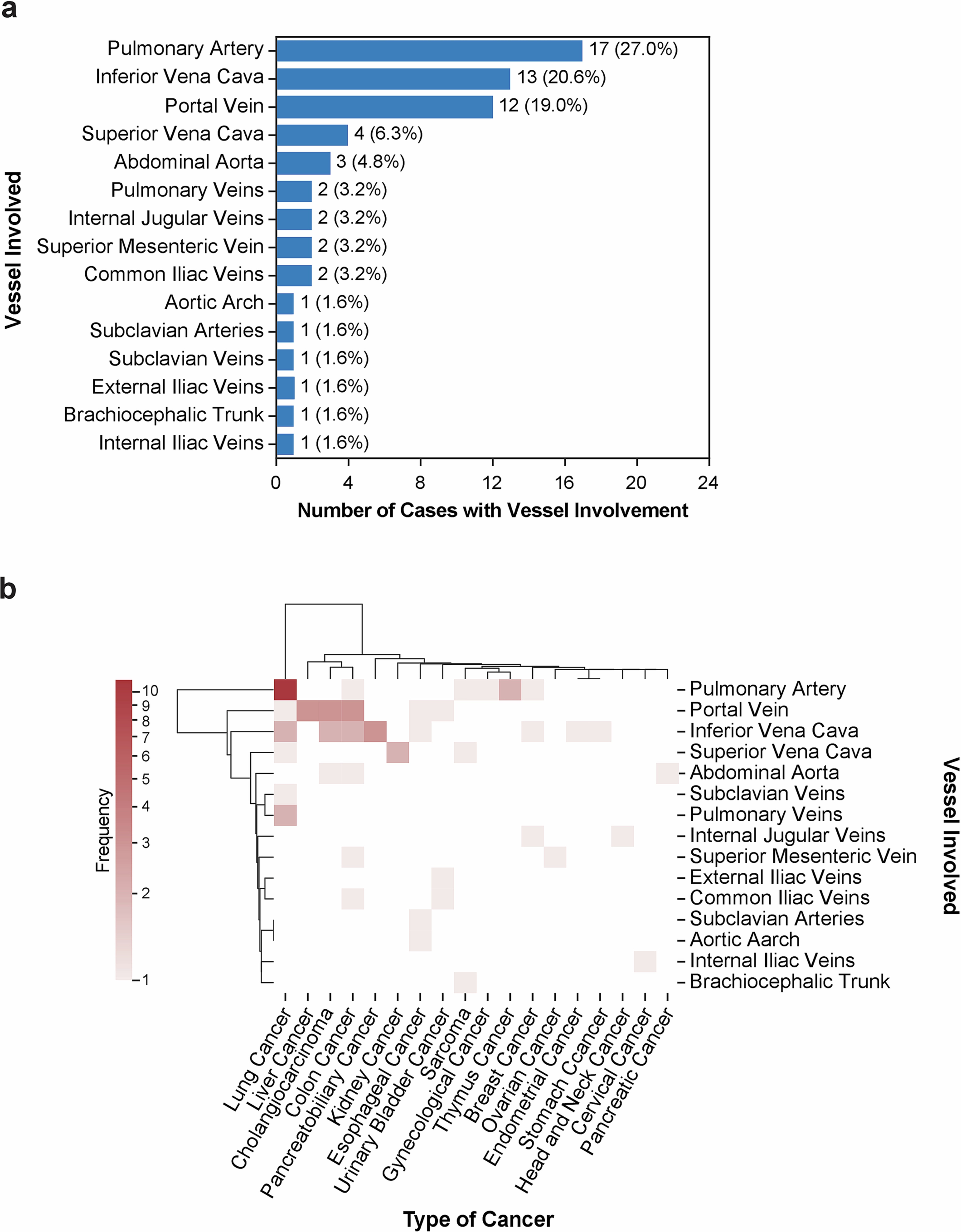 Extended Data Fig. 3: Characteristics of macrovascular infiltration in the UTSW retrospective cohort.