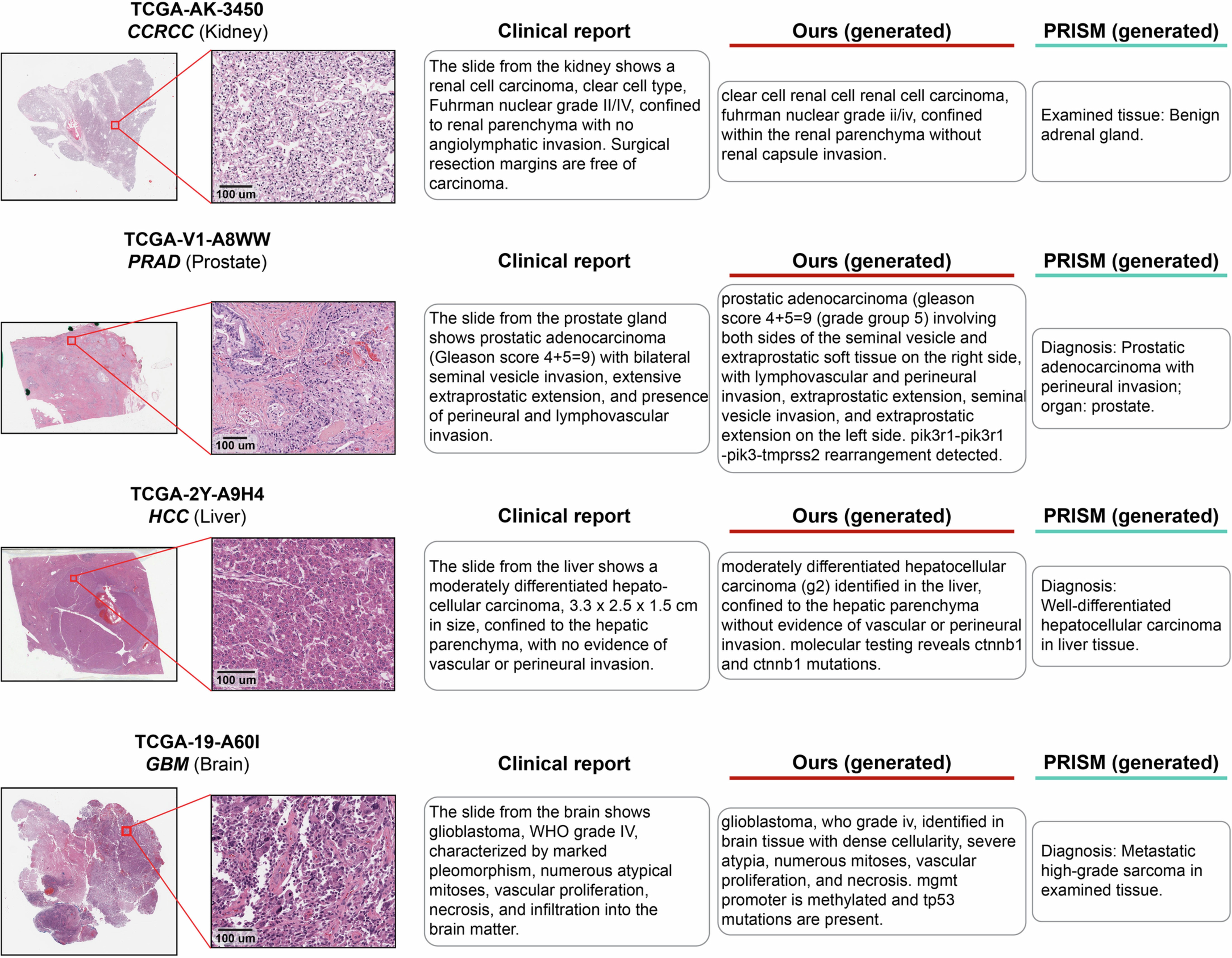 Extended Data Fig. 7: Examples of generated reports.