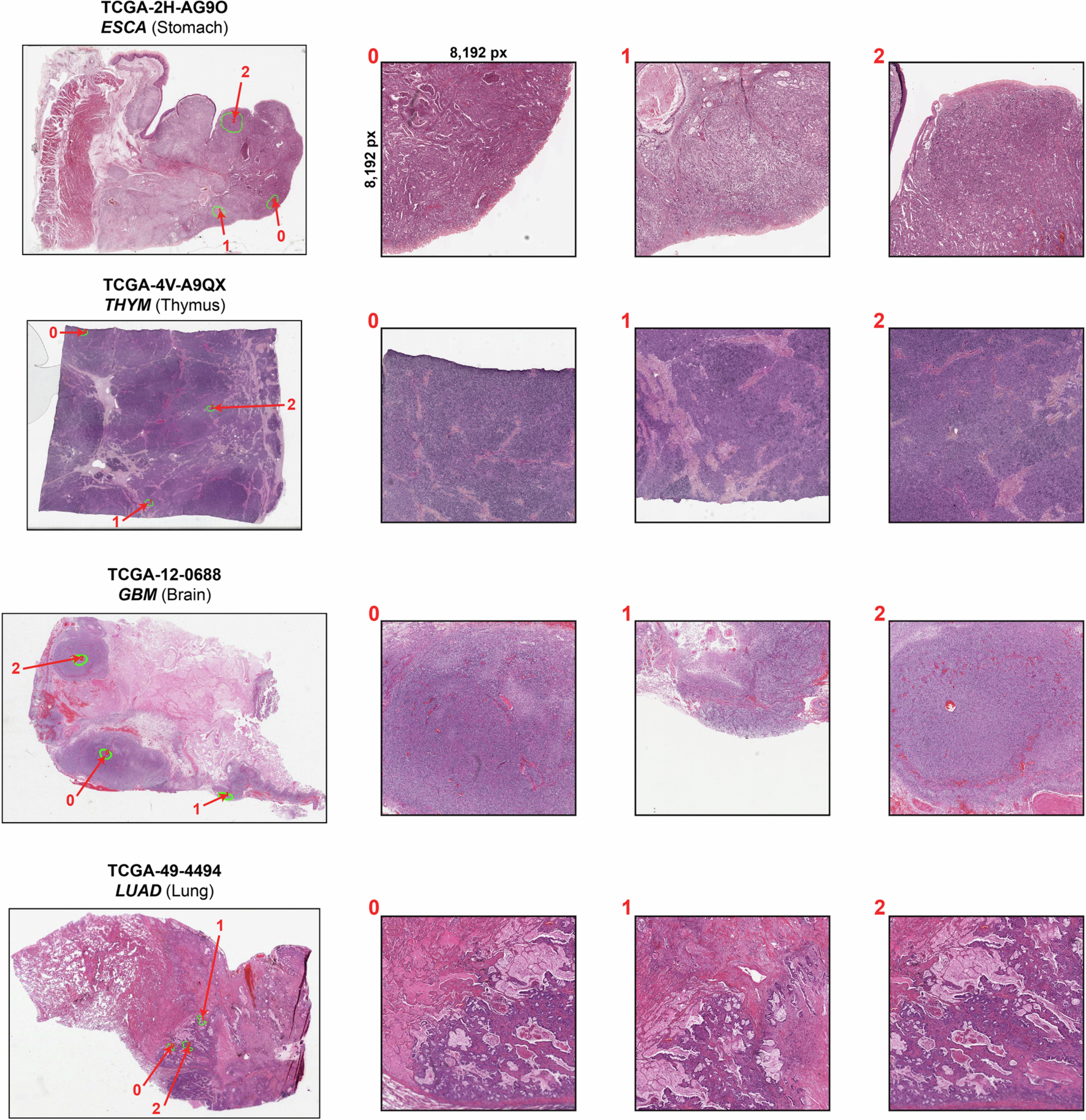 Extended Data Fig. 1: Examples of TCGA-UT-8K dataset.