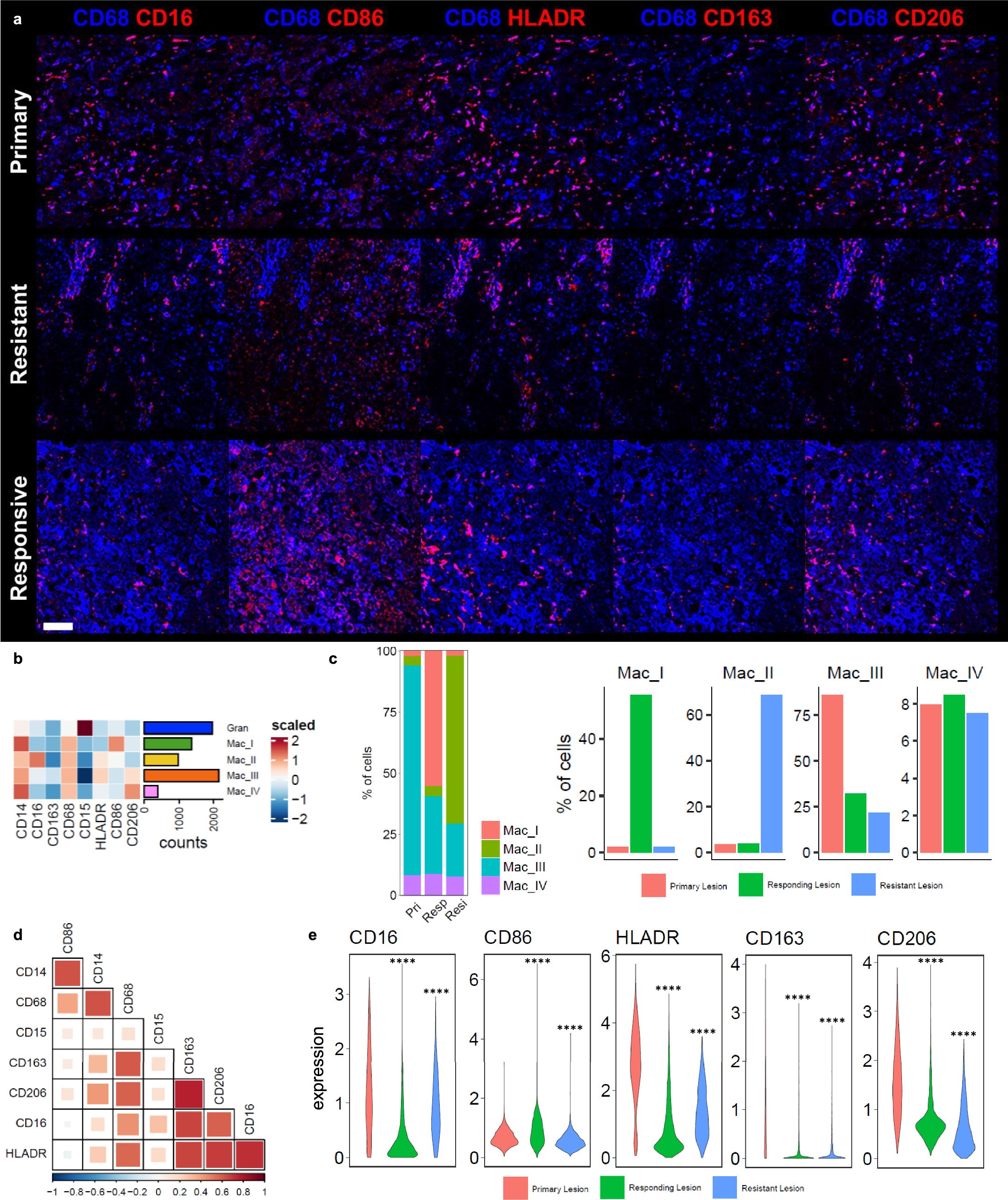 Extended Data Fig. 10: Myeloid reprogramming in a resistant lesion.