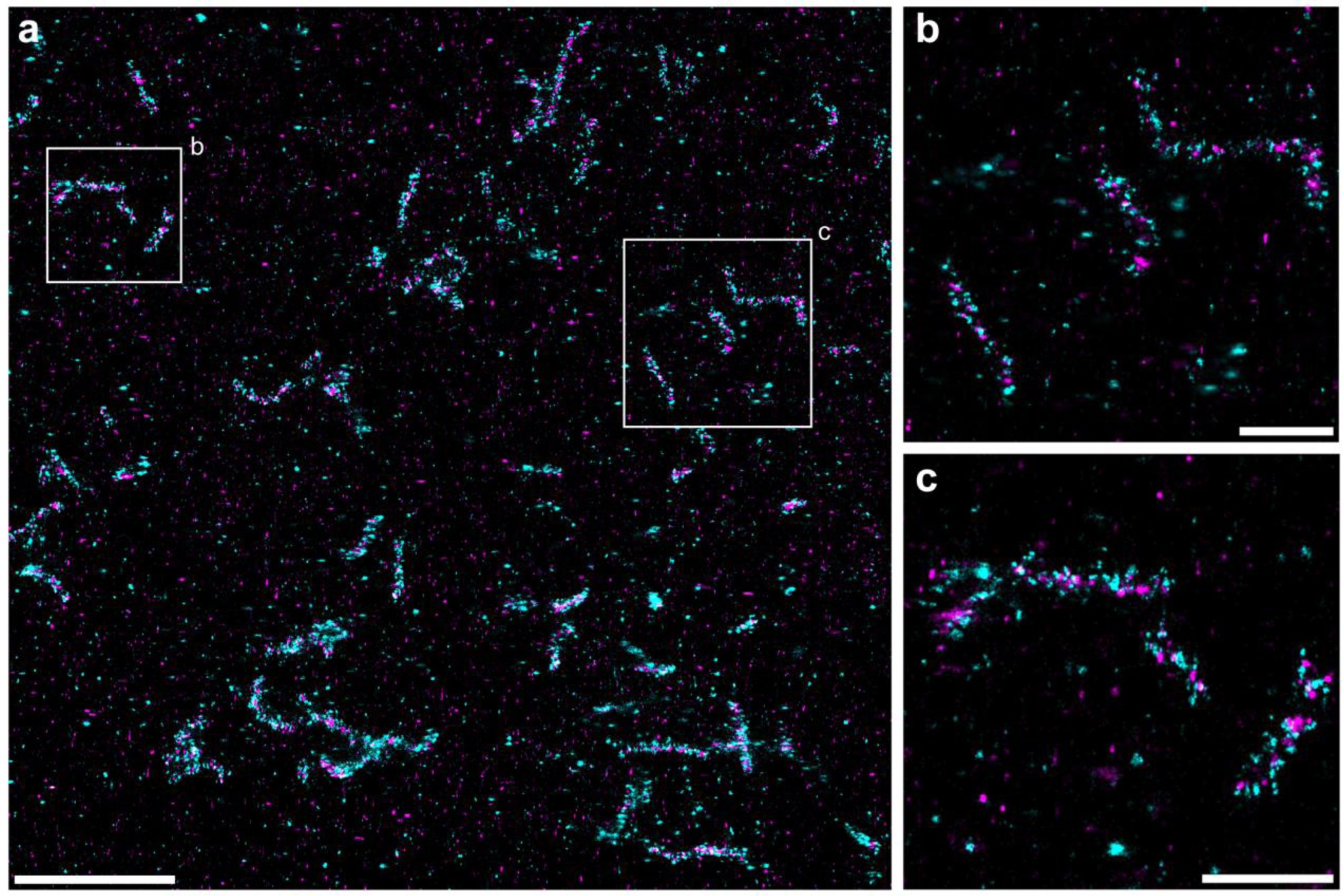 Supplementary Figure 8: 3D Exchange-PAINT imaging of PMP70 and catalase in A431 cells.