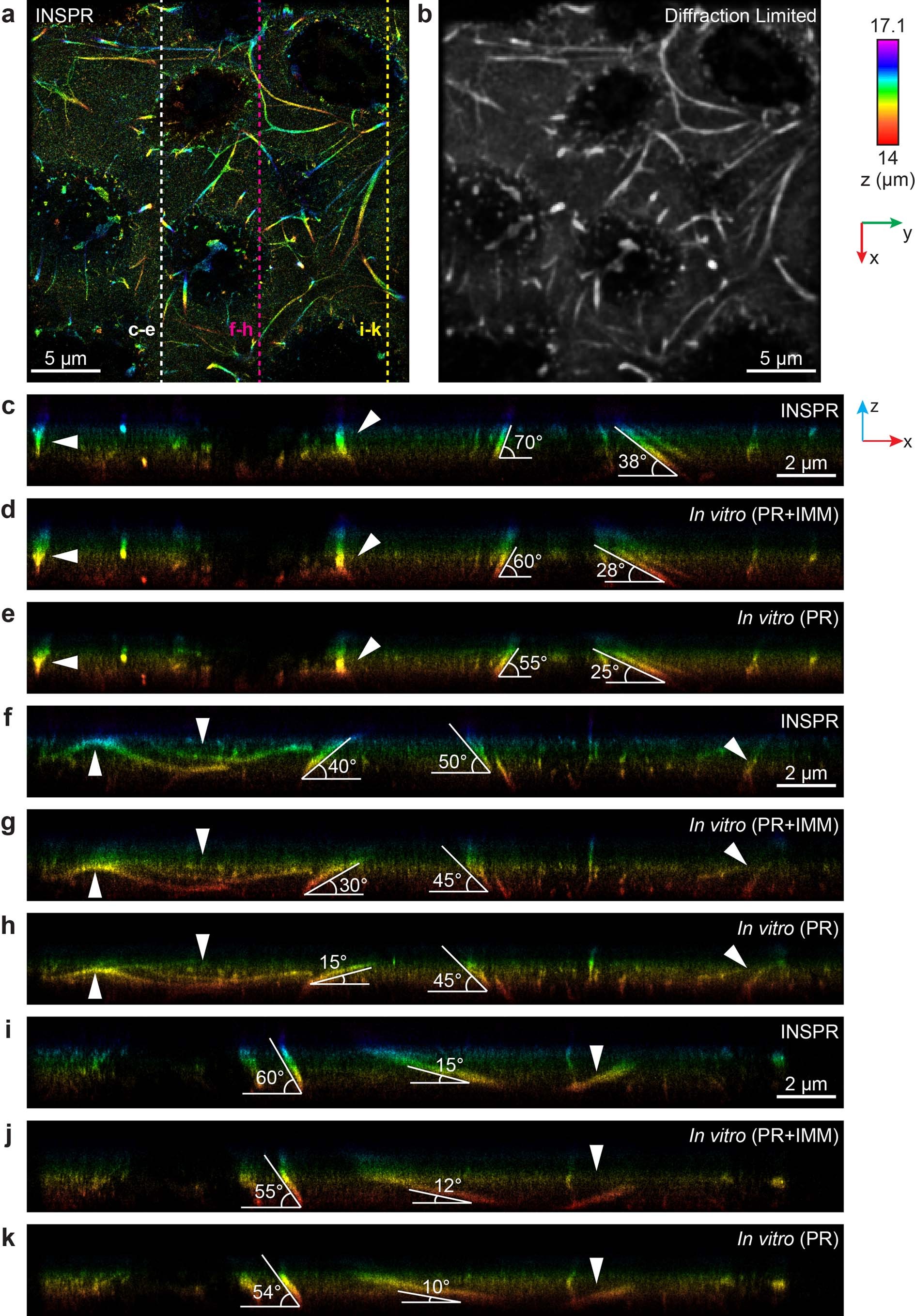 Extended Data Fig. 10: 3D super-resolution reconstructions of immunofluorescence-labeled elastic fibers in developing cartilage in 20-μm-thick tissue slices using INSPR and in vitro methods in biplane setup.