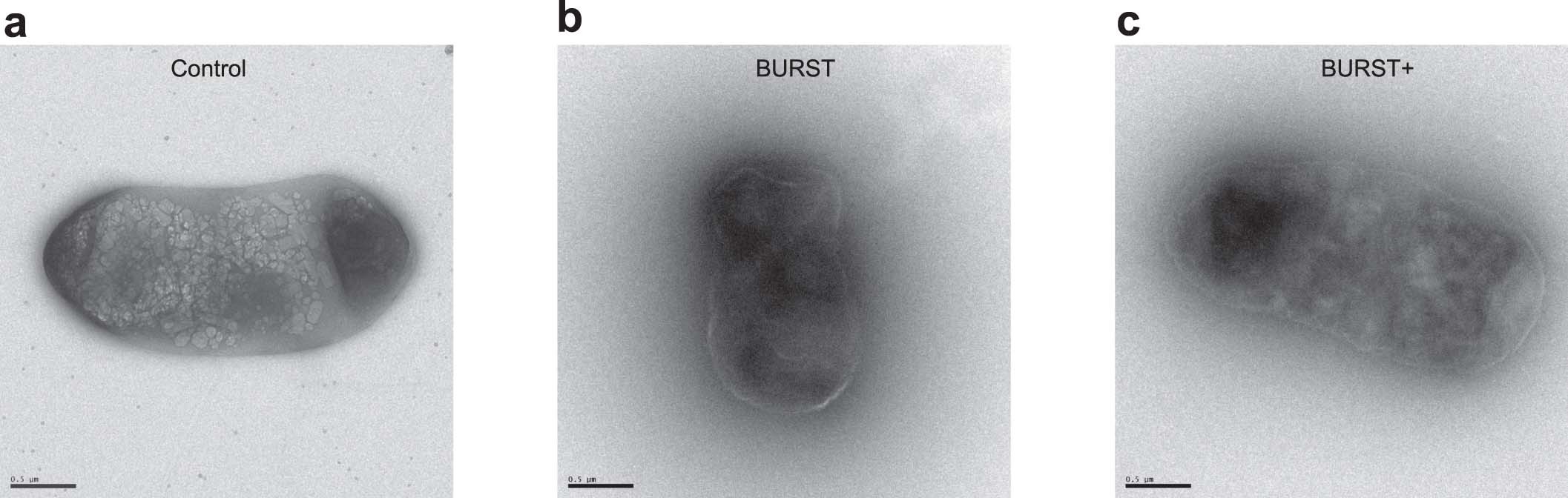 Extended Data Fig. 3: Transmission electron micrographs of ARG-expressing E. coli Nissle cells after imaging.