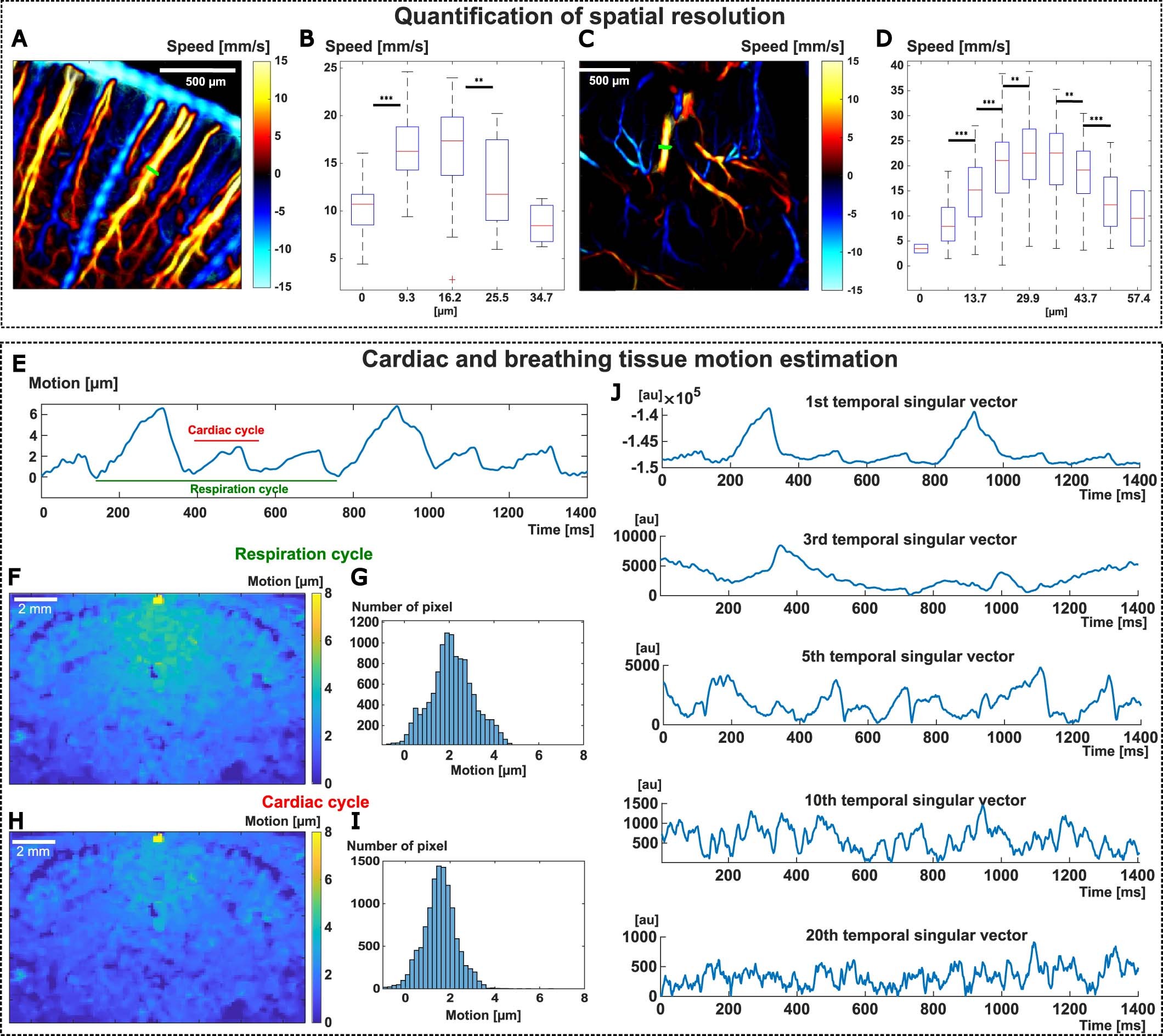 Extended Data Fig. 10: Quantification of fULM spatial resolution, cardiac and respiratory motion.