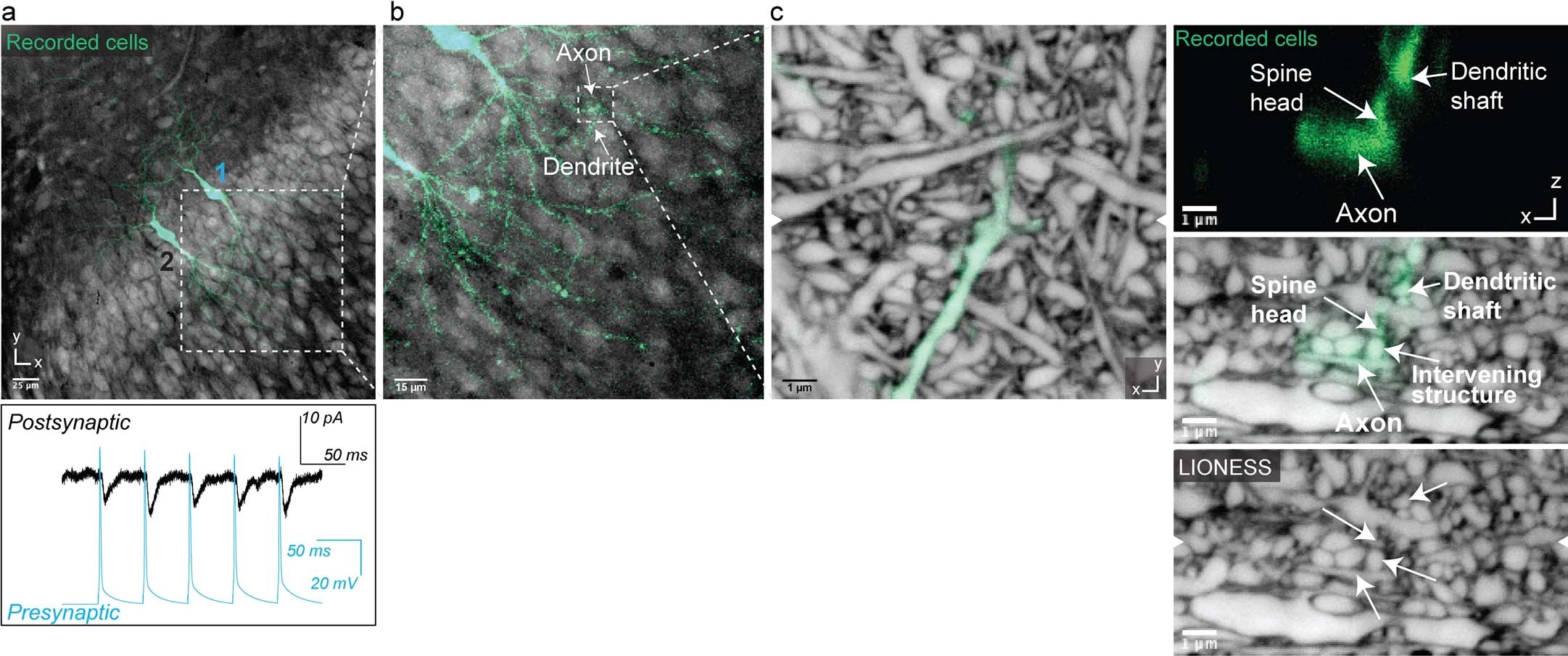 Extended Data Fig. 9: Correlating structural with electrophysiological information.