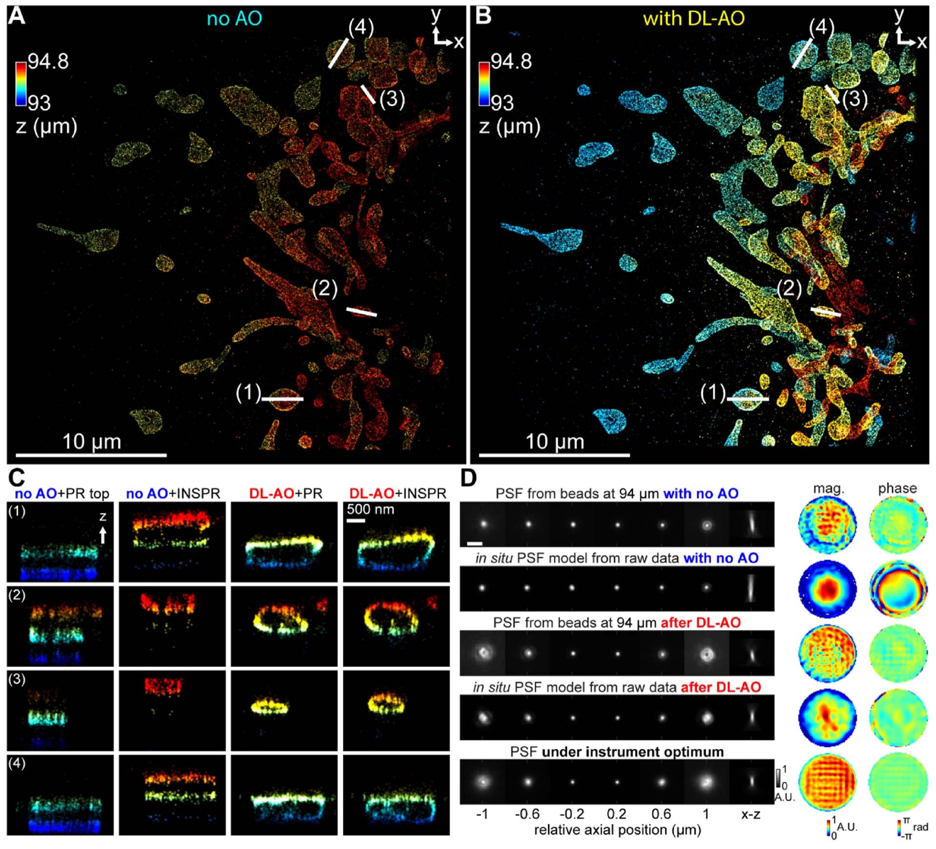 Extended Data Fig. 8: Demonstrations of DL-AO correcting index mismatch induced aberration by imaging Tom20 proteins in COS-7 cells through 94 μm water-based imaging media.
