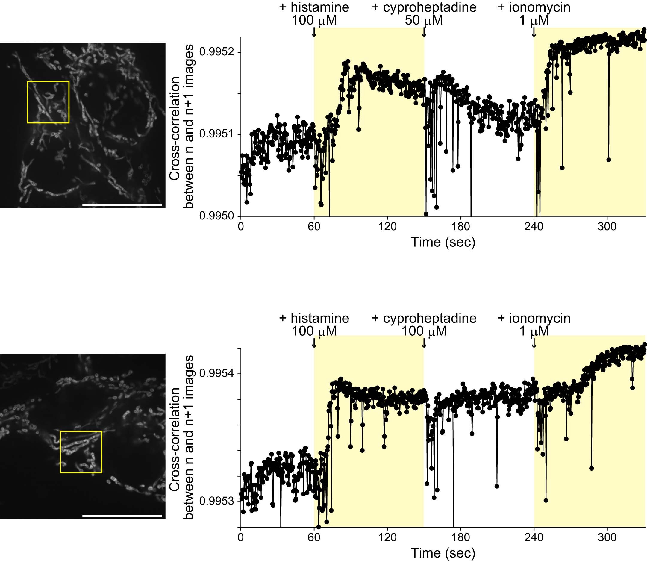 Extended Data Fig. 9: Agonist-, antagonist-, and Ca2+ ionophore-induced longitudinal changes in IMM structures revealed by fast, sustained, wide imaging.