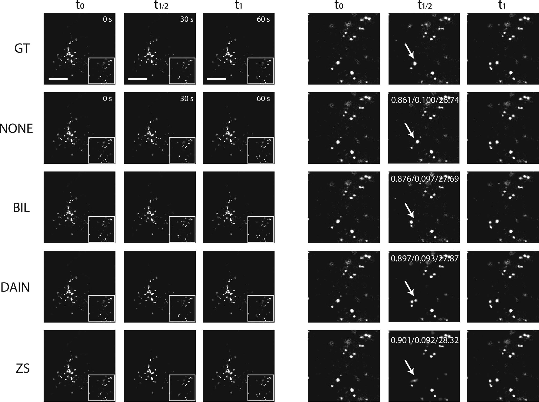 Extended Data Fig. 7: 2x frame interpolation on moving lysosome of SHSY5Y cells.