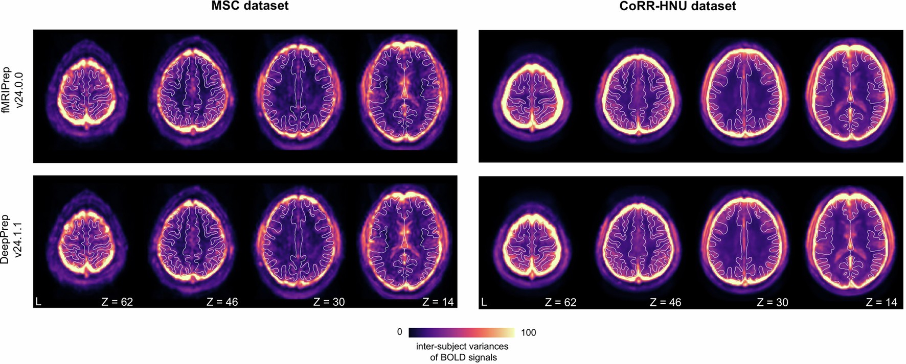 Extended Data Fig. 6: Comparable inter-subject variances in average BOLD signals between DeepPrep and fMRIPrep.
