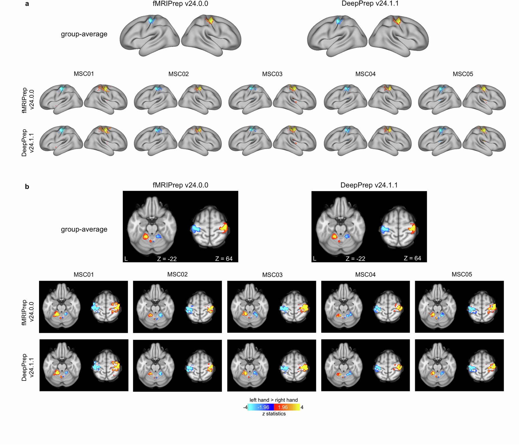 Extended Data Fig. 7: Comparable patterns and strength of task-evoked responses between DeepPrep and fMRIPrep.